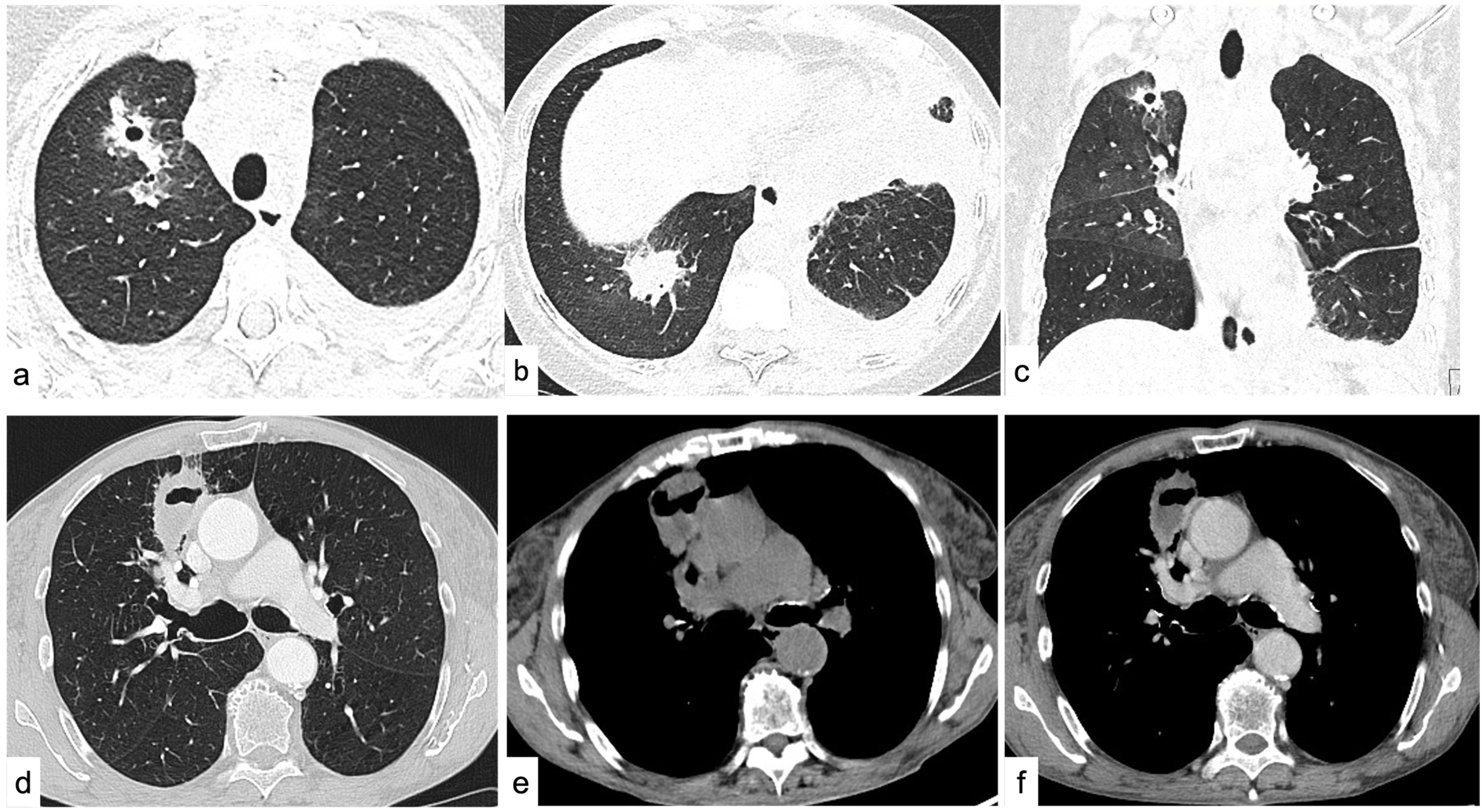 Tomography 09 00095 g003