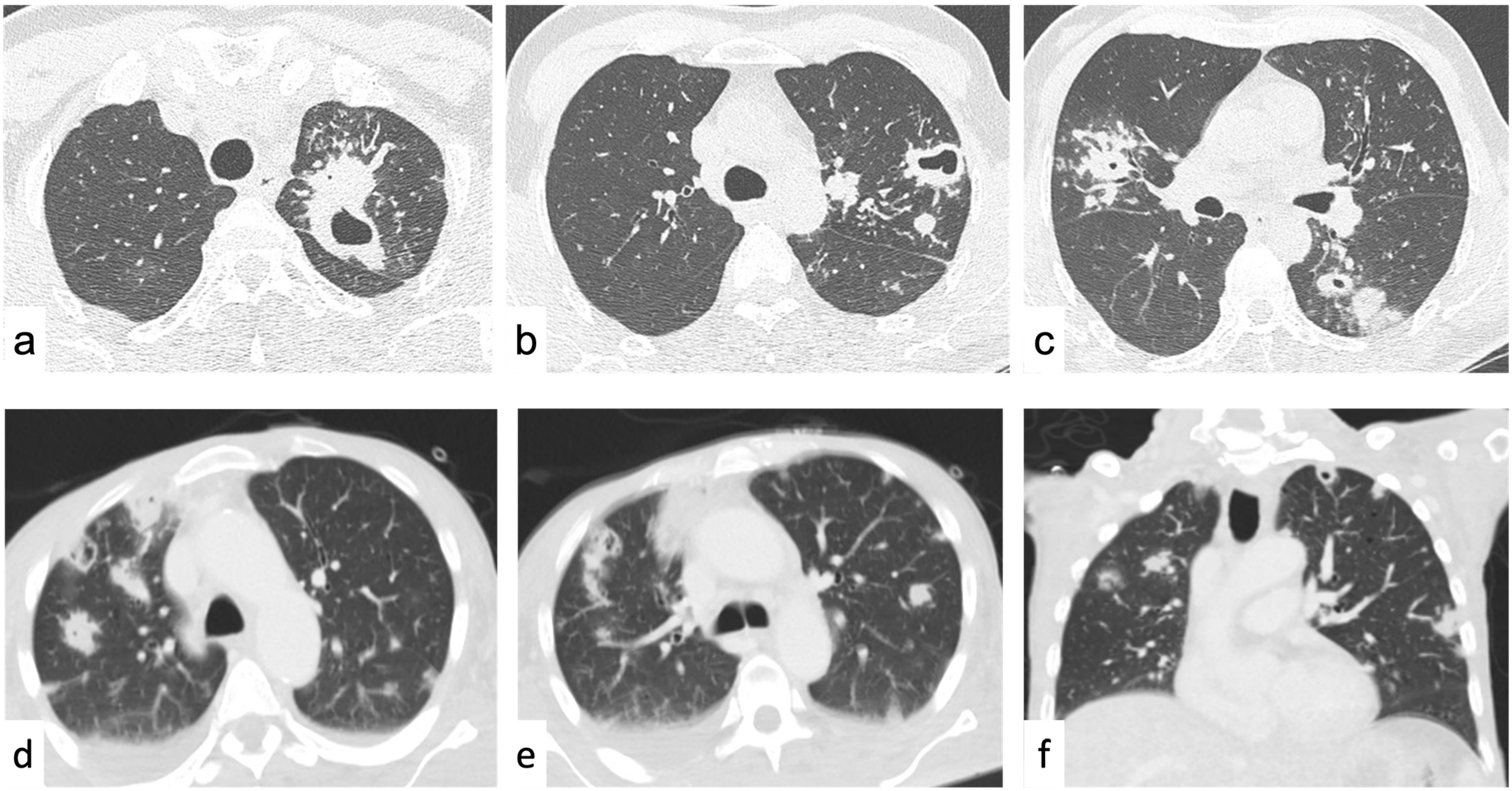 Tomography 09 00095 g004