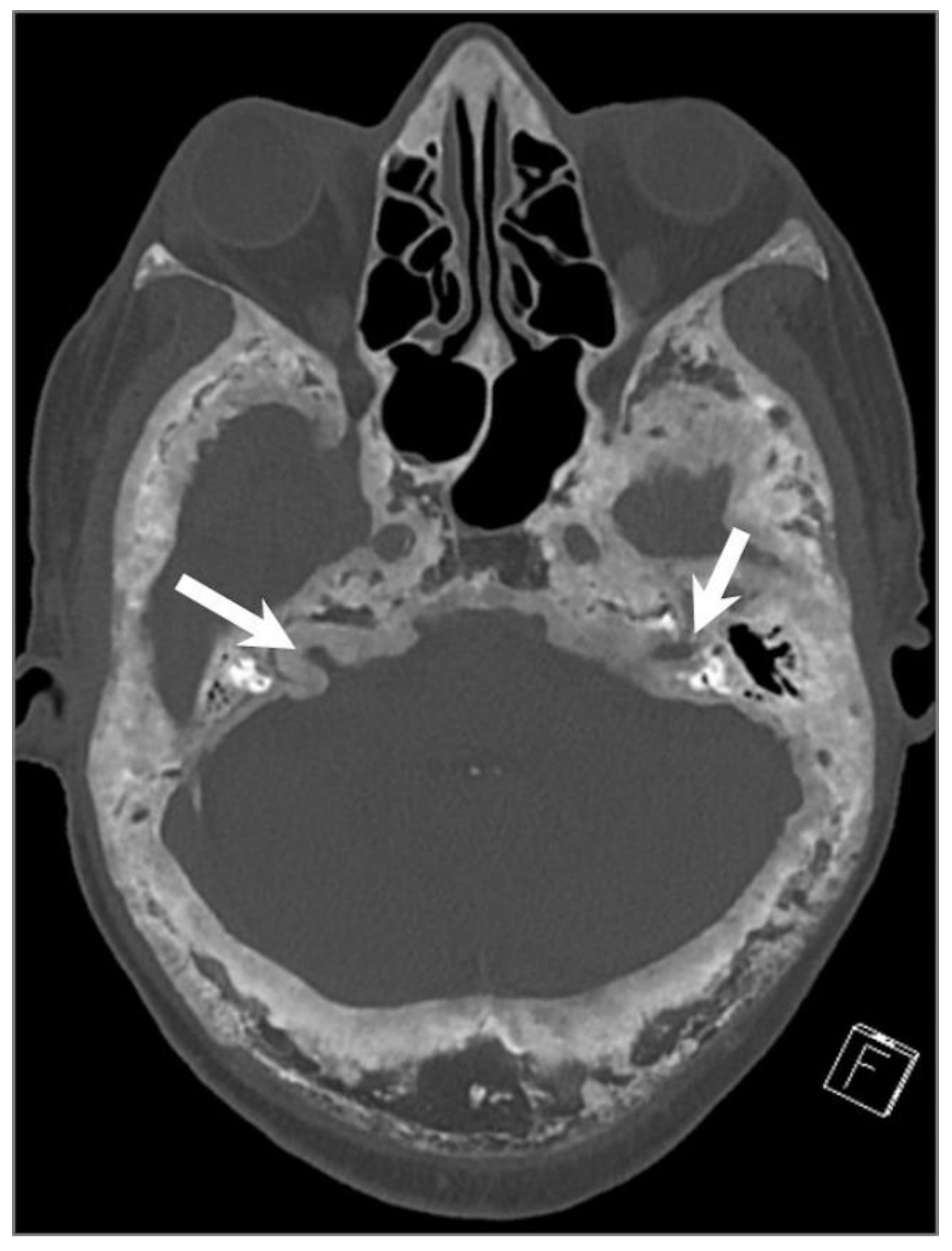 Tomography 09 00097 g031 Tomography 09 00097 g031