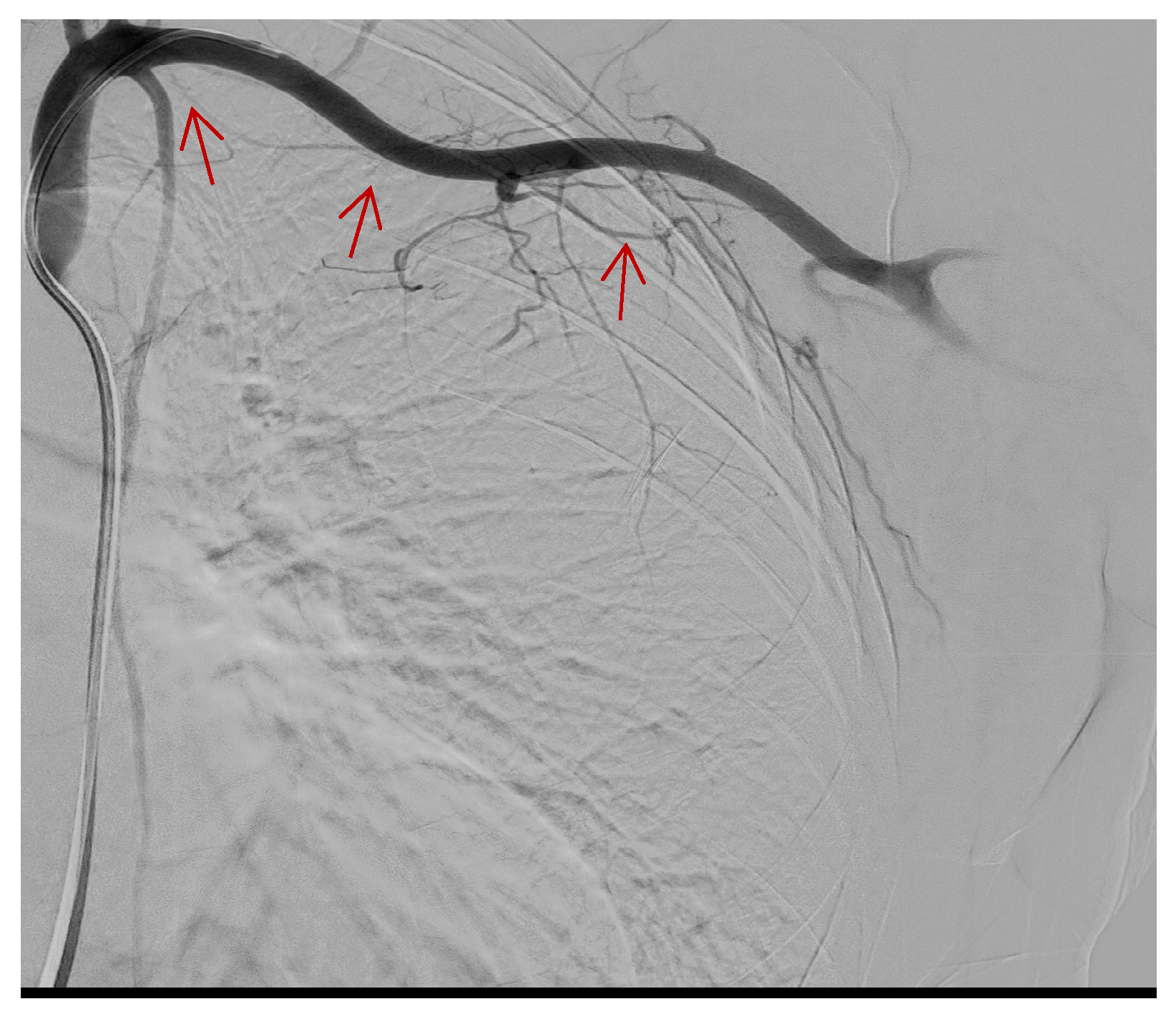 Tomography 09 00099 g003 Tomography 09 00099 g003