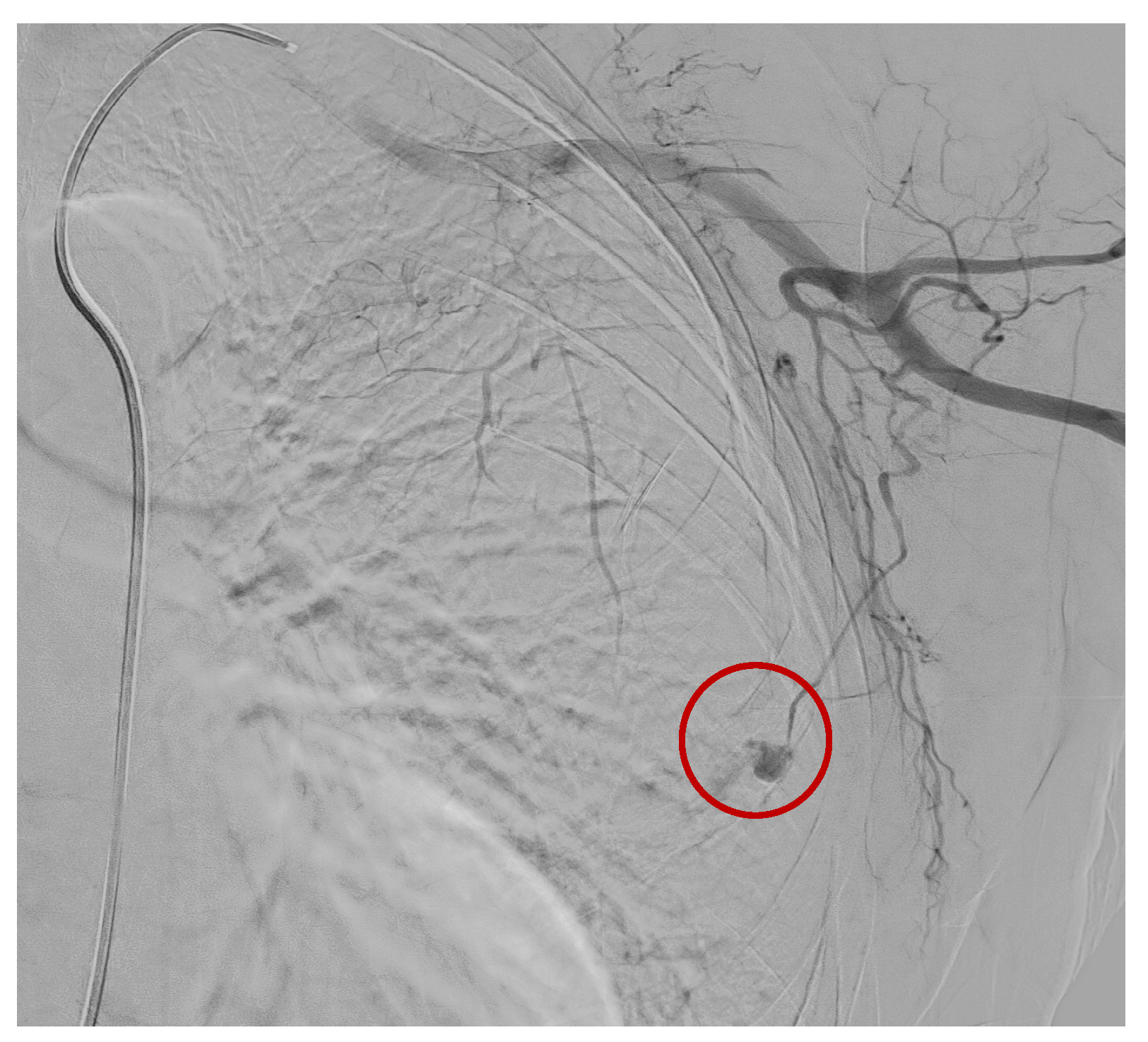 Tomography 09 00099 g004 Tomography 09 00099 g004