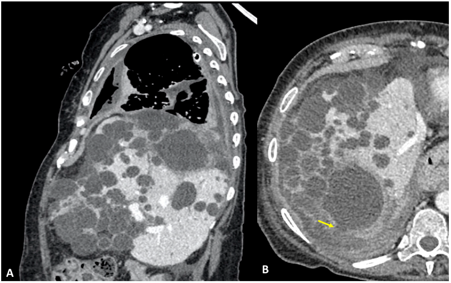 Tomography 09 00108 g001 Tomography 09 00108 g001
