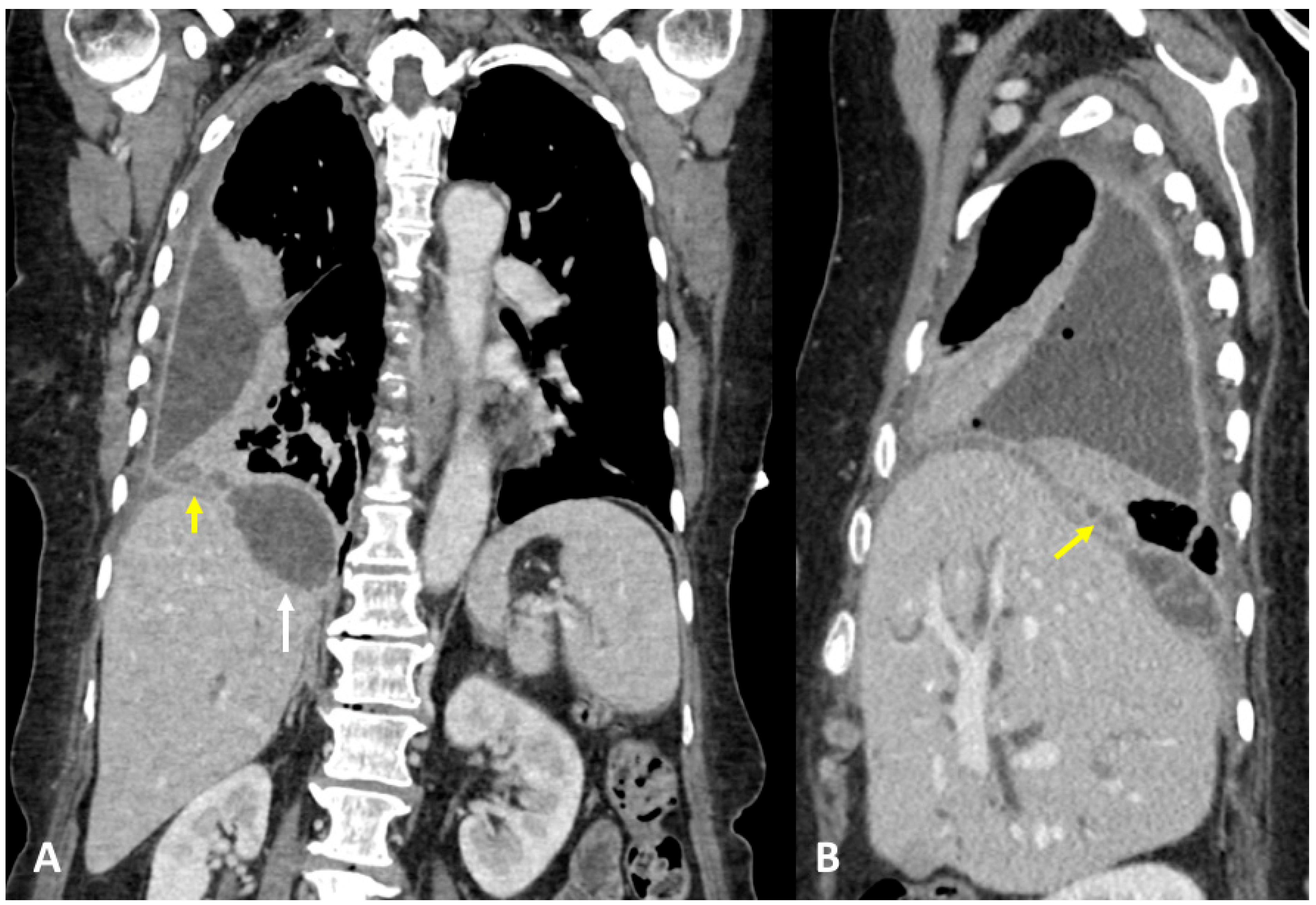 Tomography 09 00108 g005 Tomography 09 00108 g005
