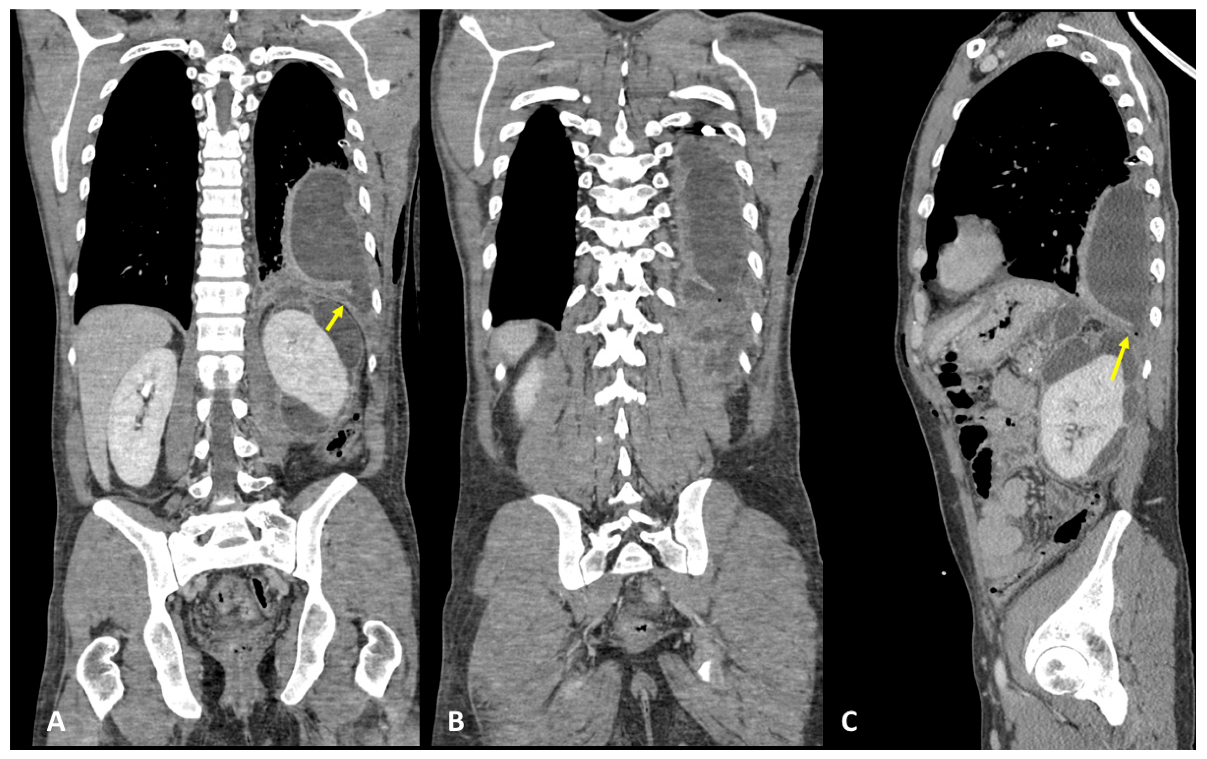 Tomography 09 00108 g007 Tomography 09 00108 g007