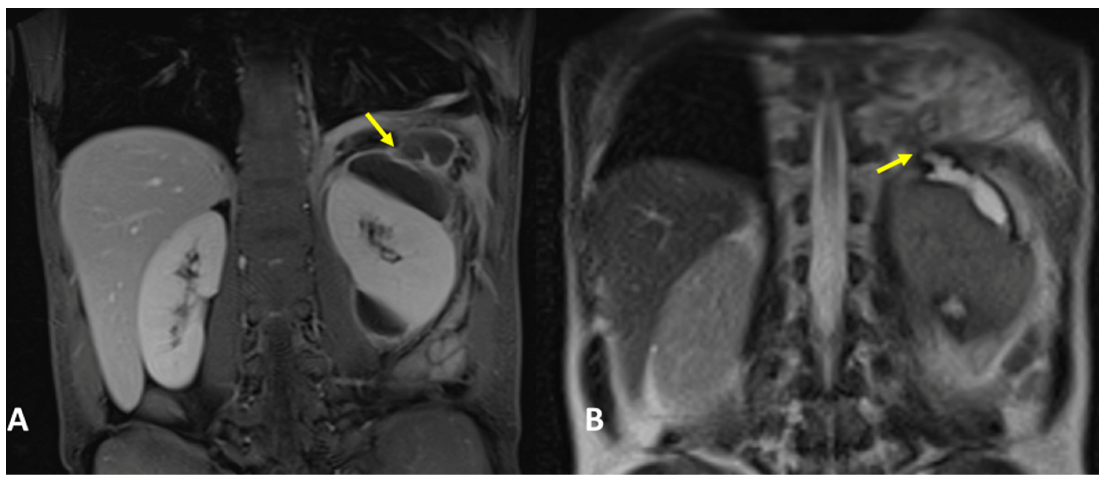 Tomography 09 00108 g008 Tomography 09 00108 g008