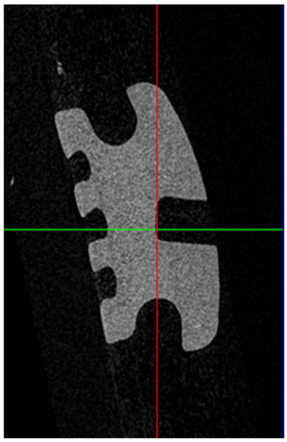 Tomography 09 00109 g003 Tomography 09 00109 g003