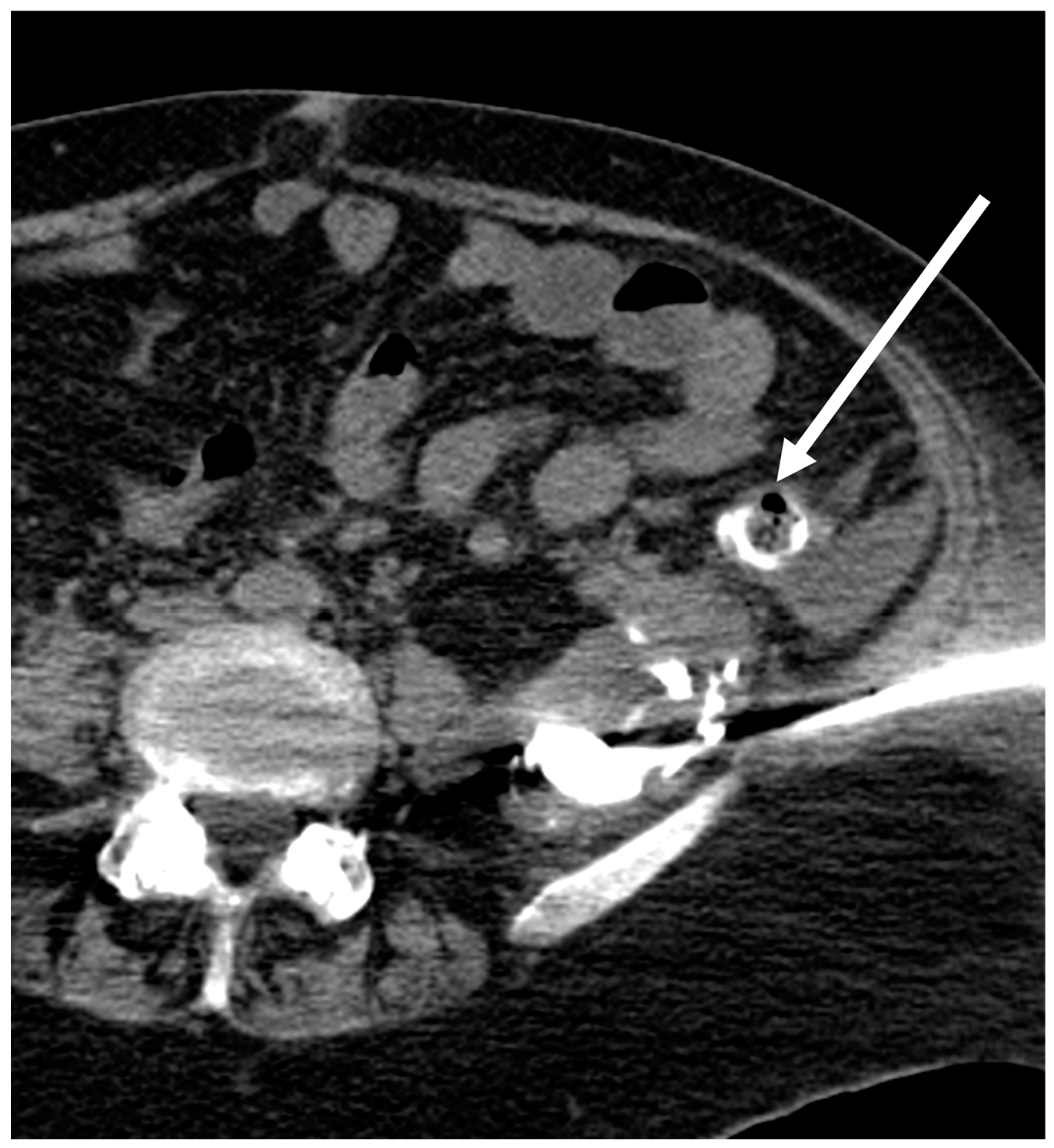 Tomography 09 00114 g004 Tomography 09 00114 g004