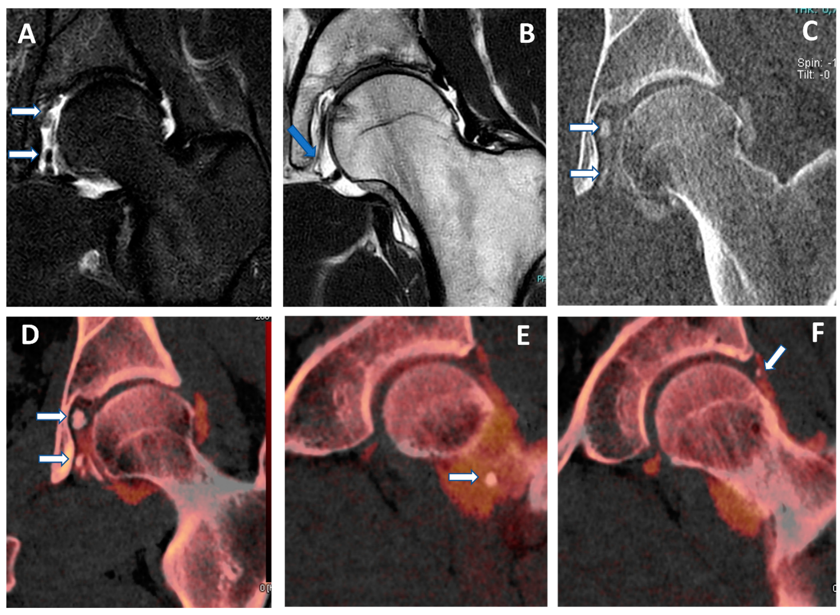 Tomography 09 00117 g005 Tomography 09 00117 g005