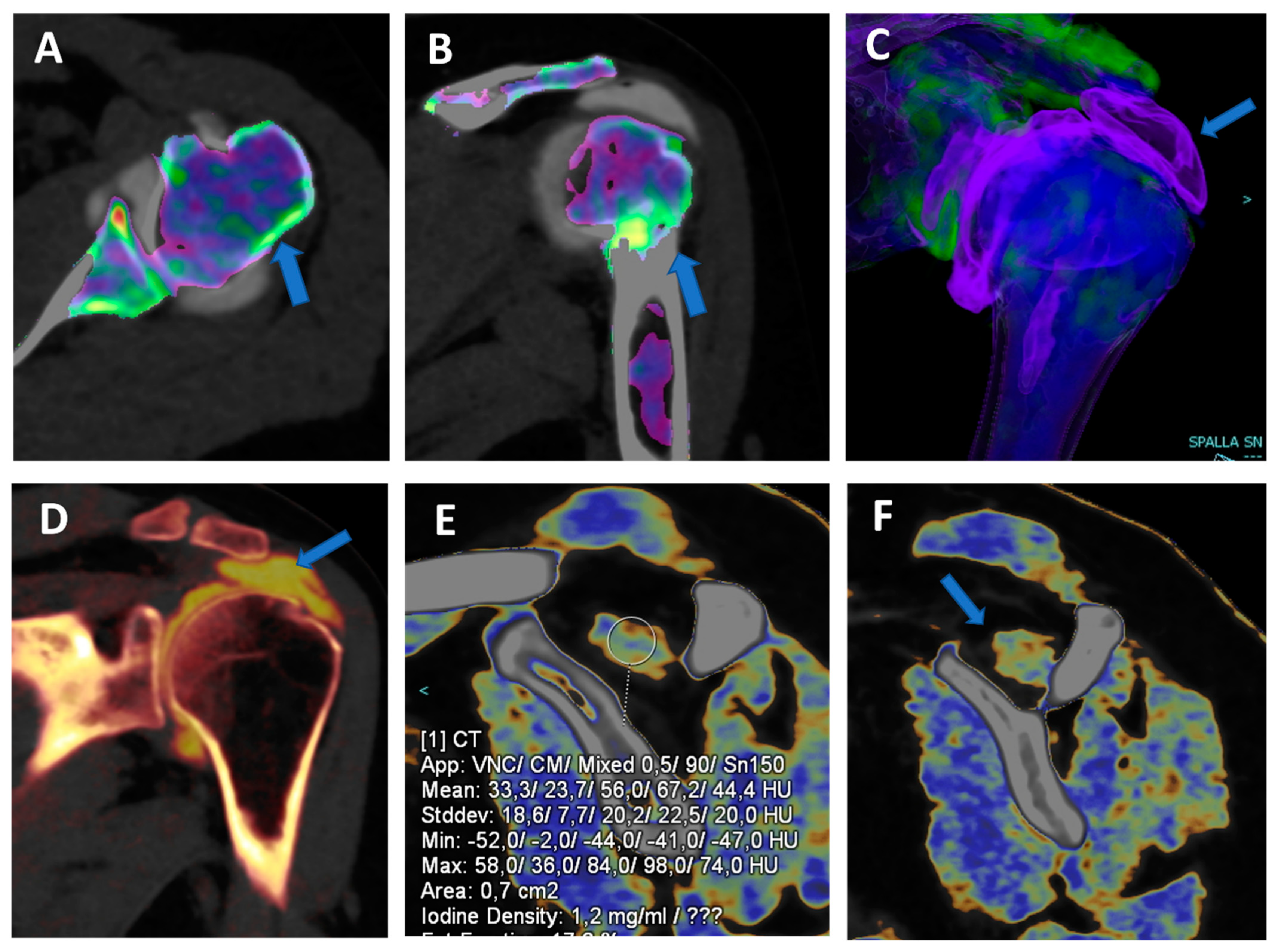 Tomography 09 00117 g006 Tomography 09 00117 g006