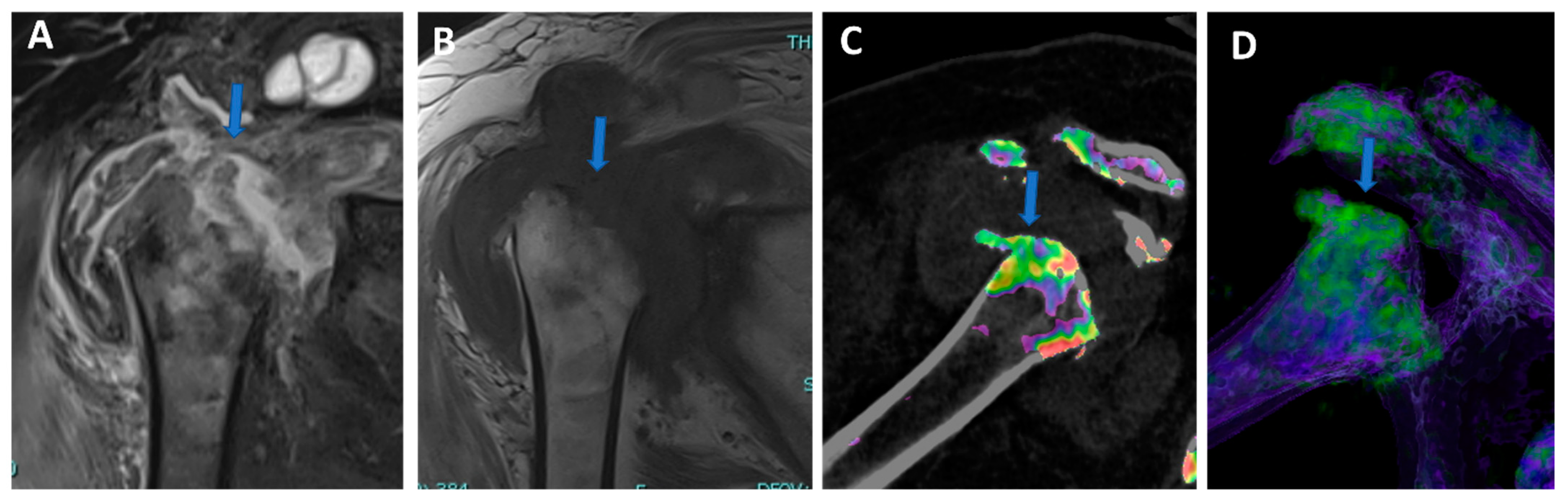 Tomography 09 00117 g007 Tomography 09 00117 g007