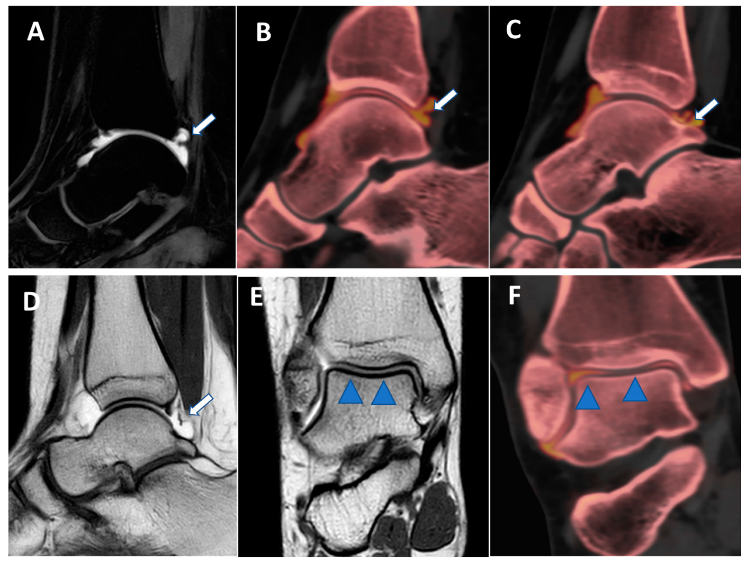 Tomography 09 00117 g008 Tomography 09 00117 g008