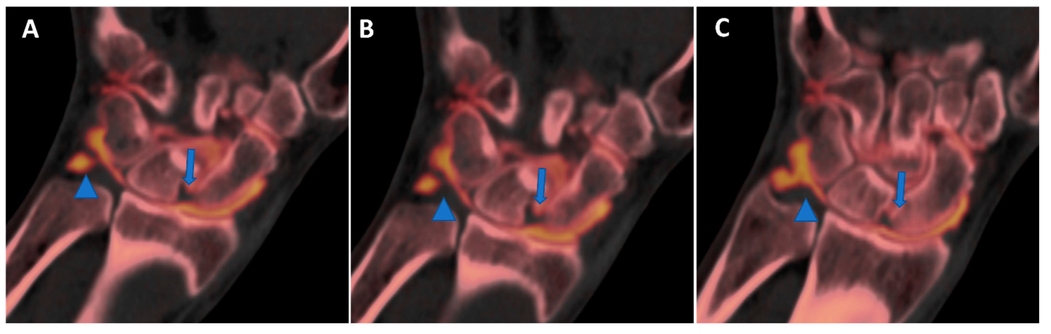 Tomography 09 00117 g010 Tomography 09 00117 g010