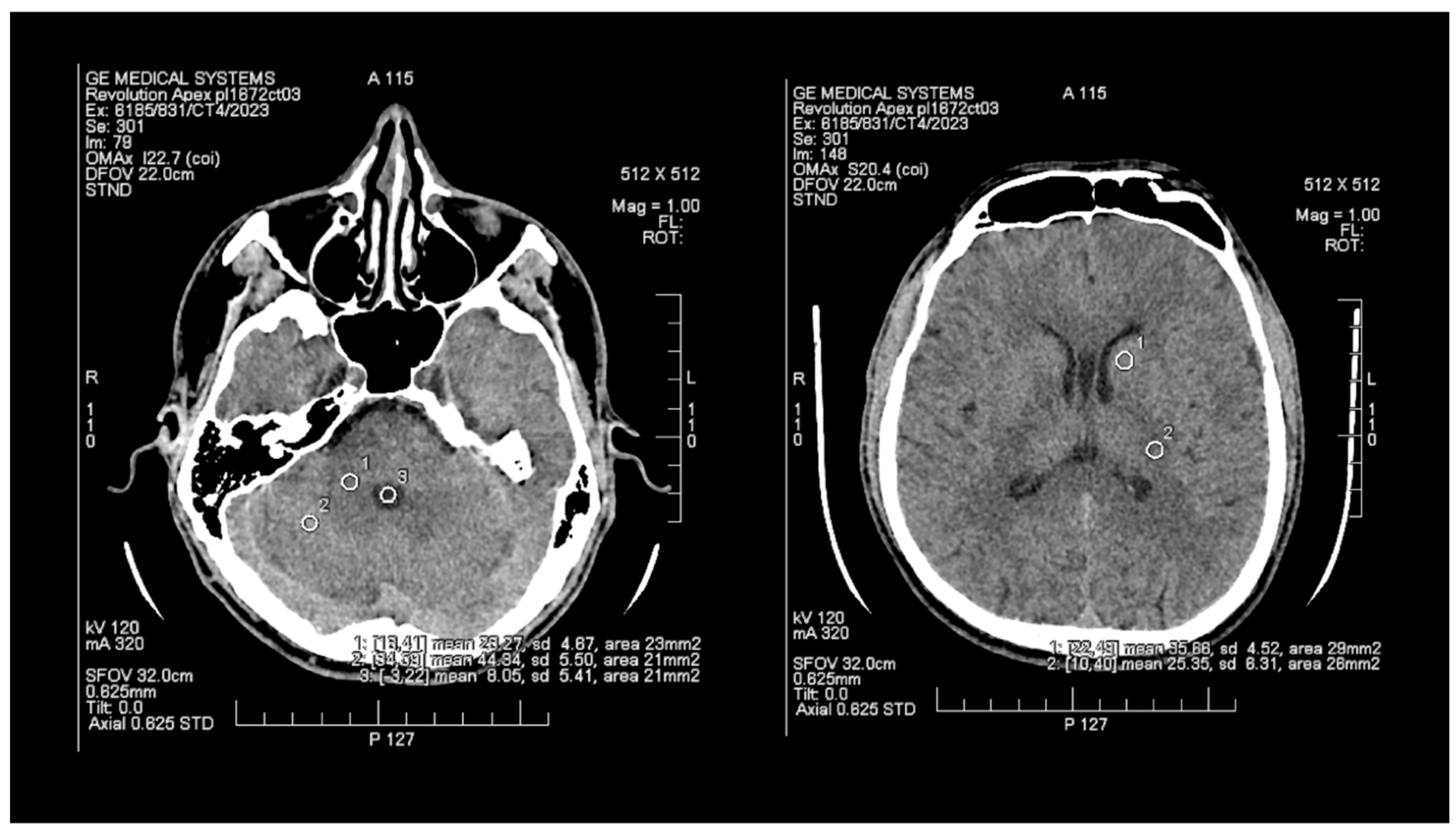 Tomography 09 00118 g001 Tomography 09 00118 g001