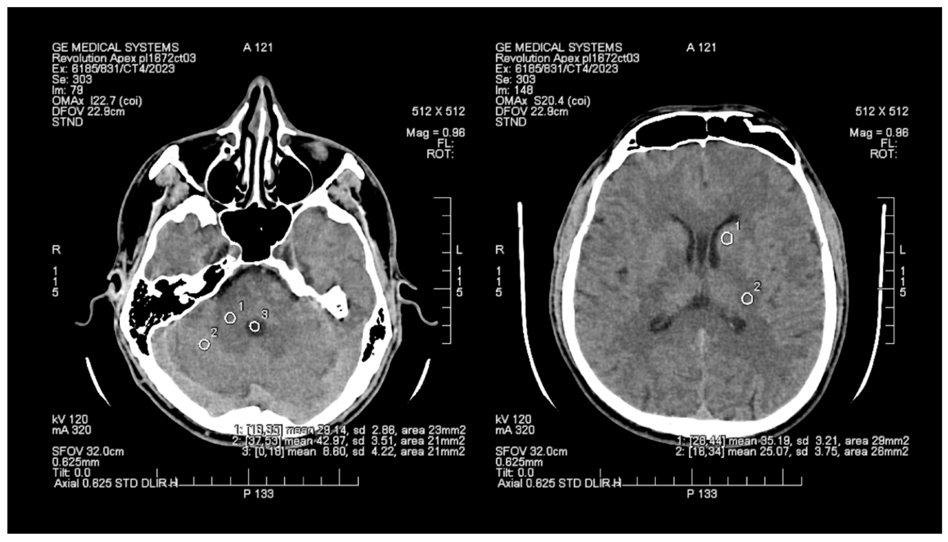 Tomography 09 00118 g002 Tomography 09 00118 g002