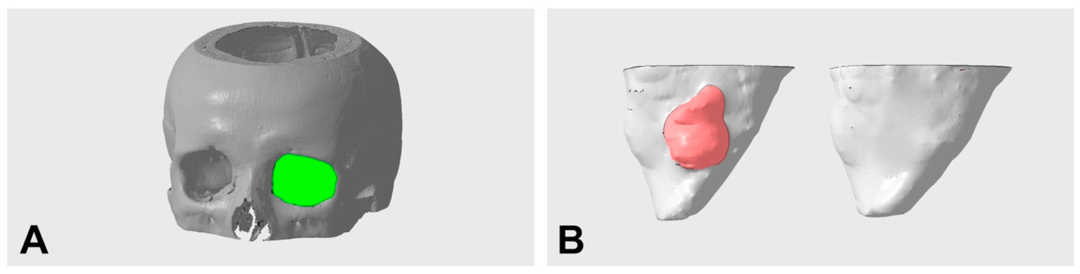 Tomography 09 00121 g003