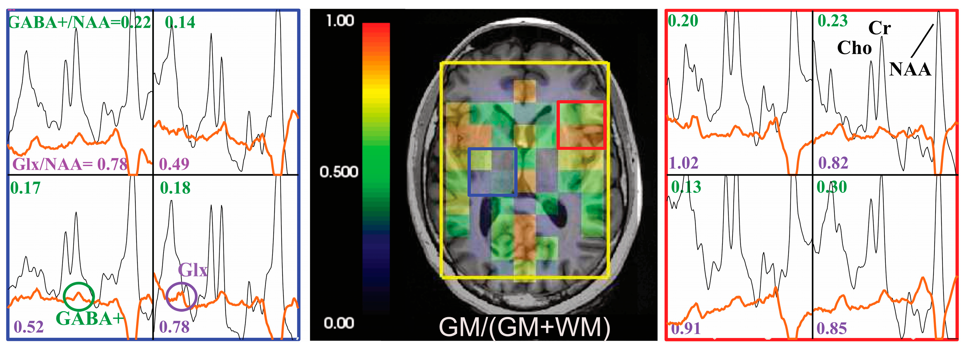 Tomography 09 00127 g004