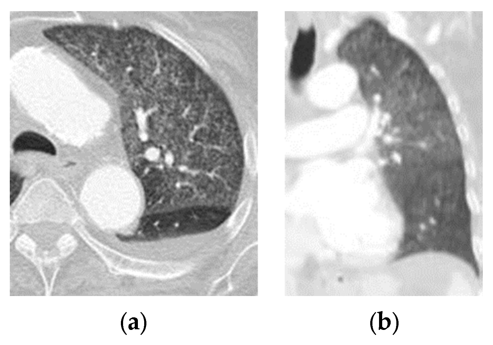 Tomography 09 00129 g002