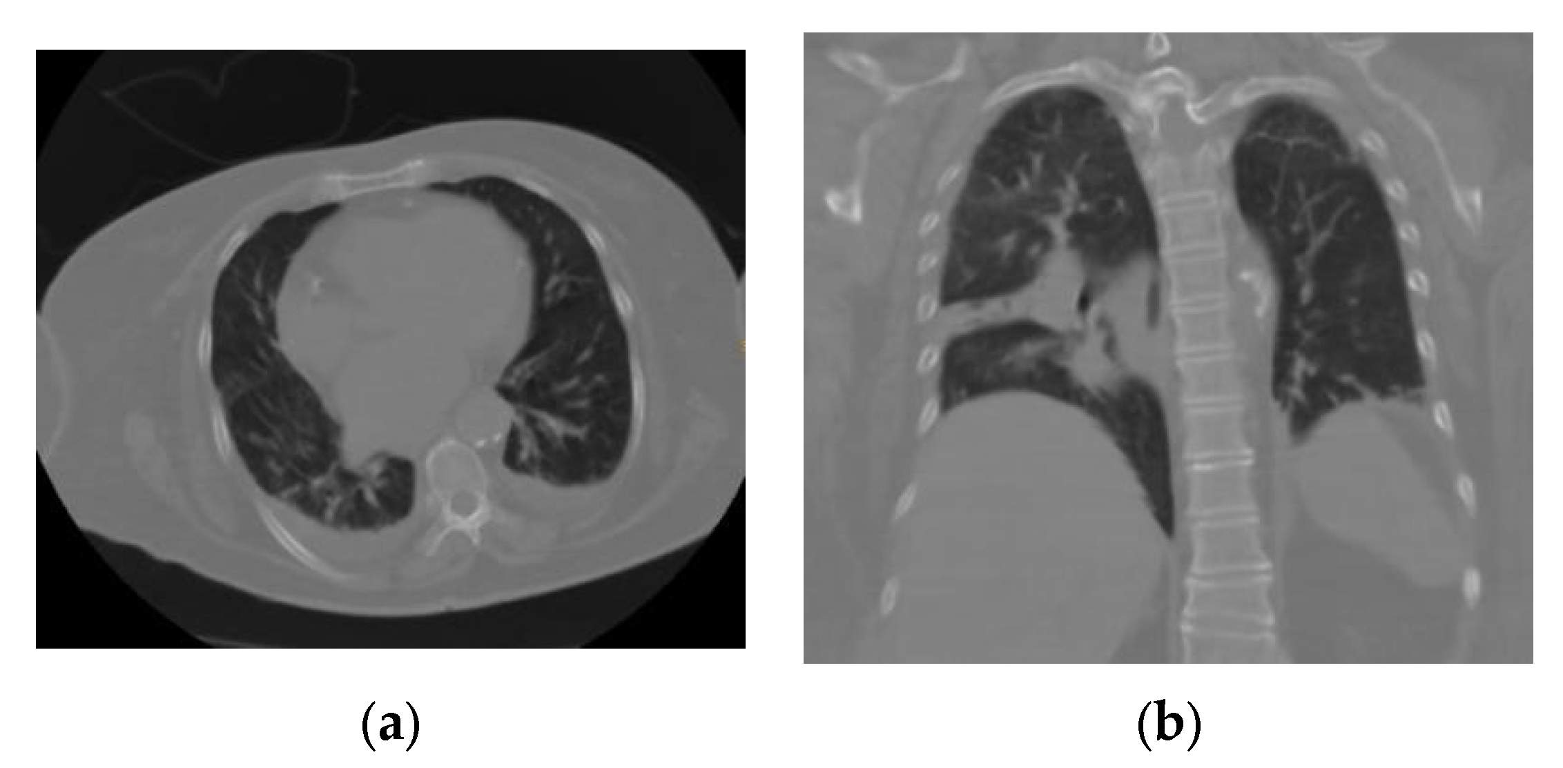 Tomography 09 00129 g003