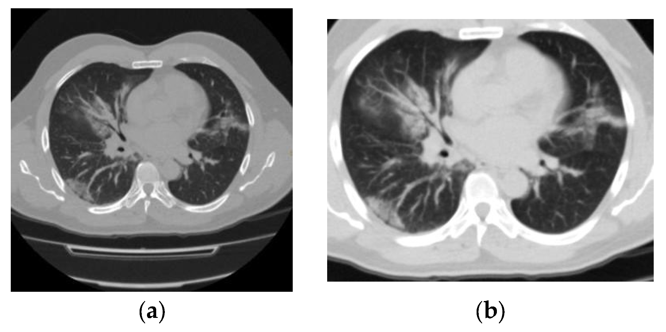 Tomography 09 00129 g005