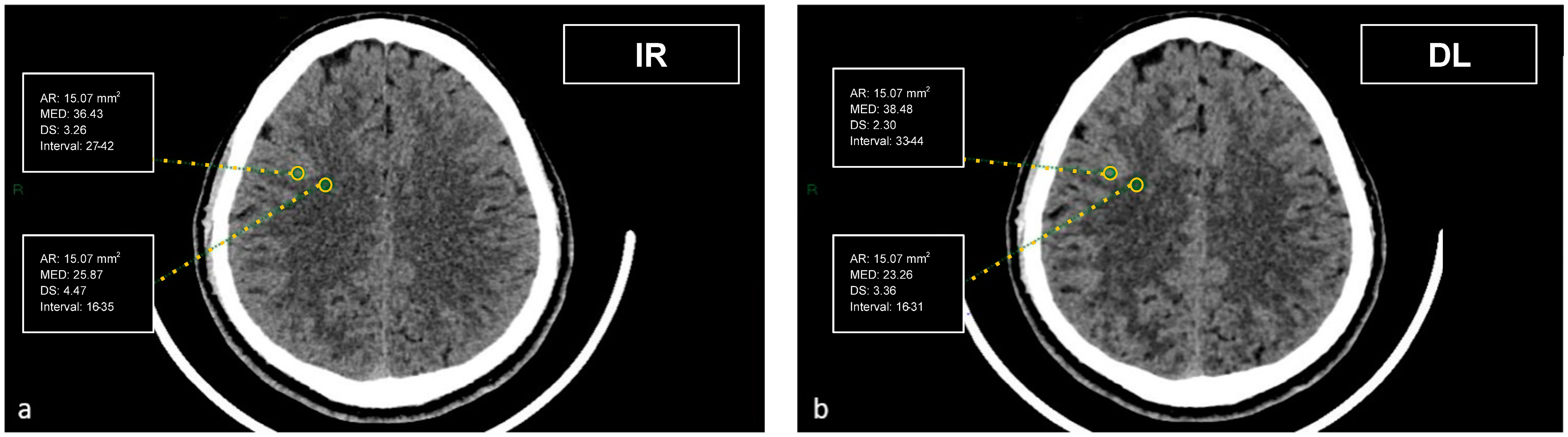 Tomography 09 00130 g001