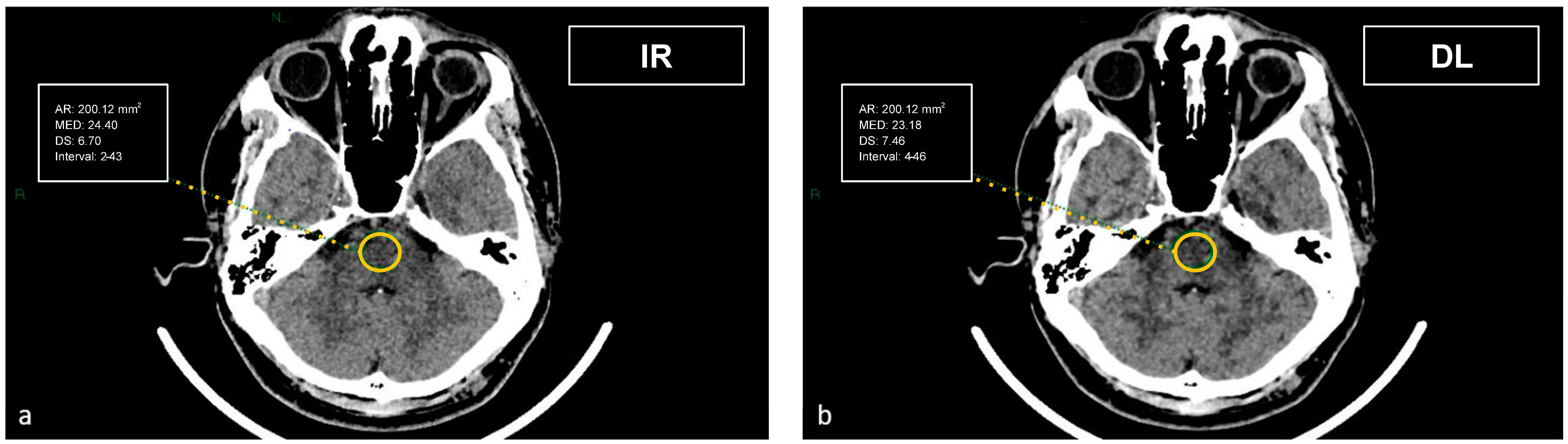 Tomography 09 00130 g003
