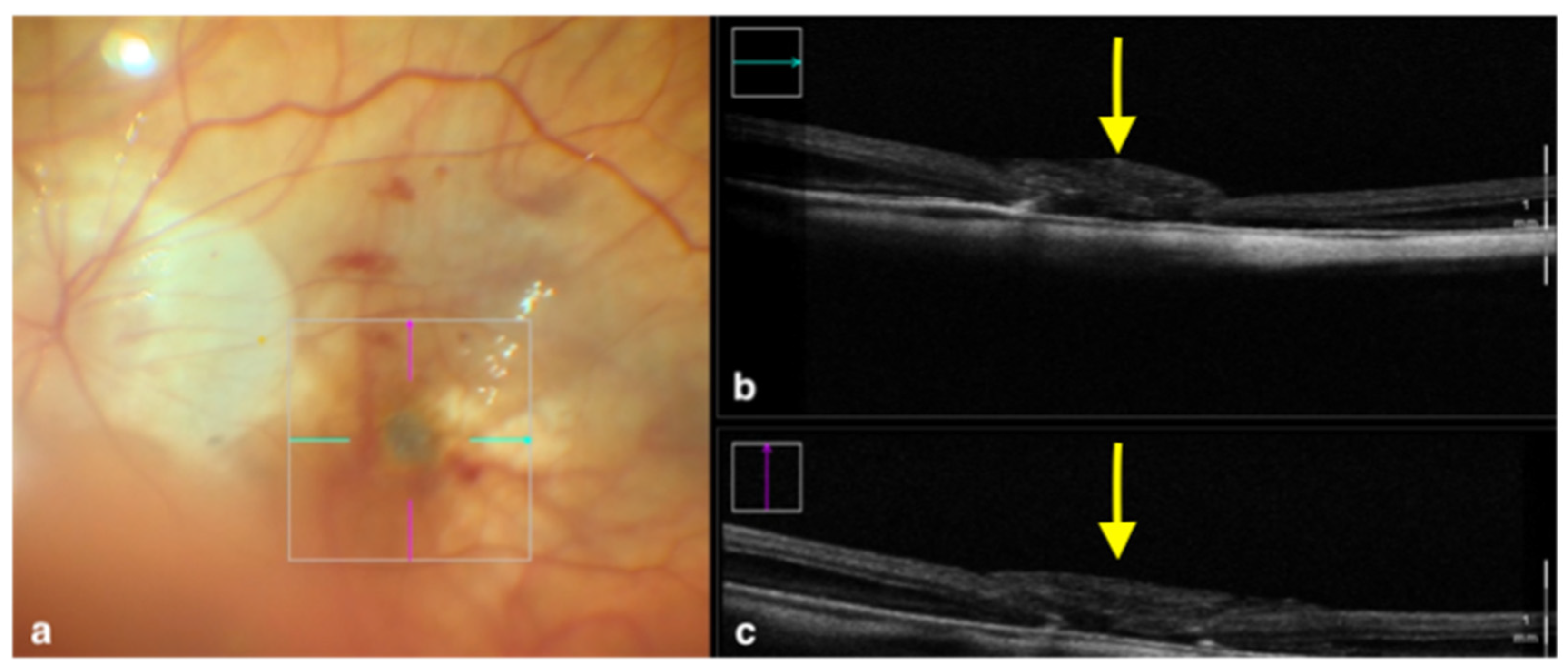 Tomography 09 00132 g002 Tomography 09 00132 g002