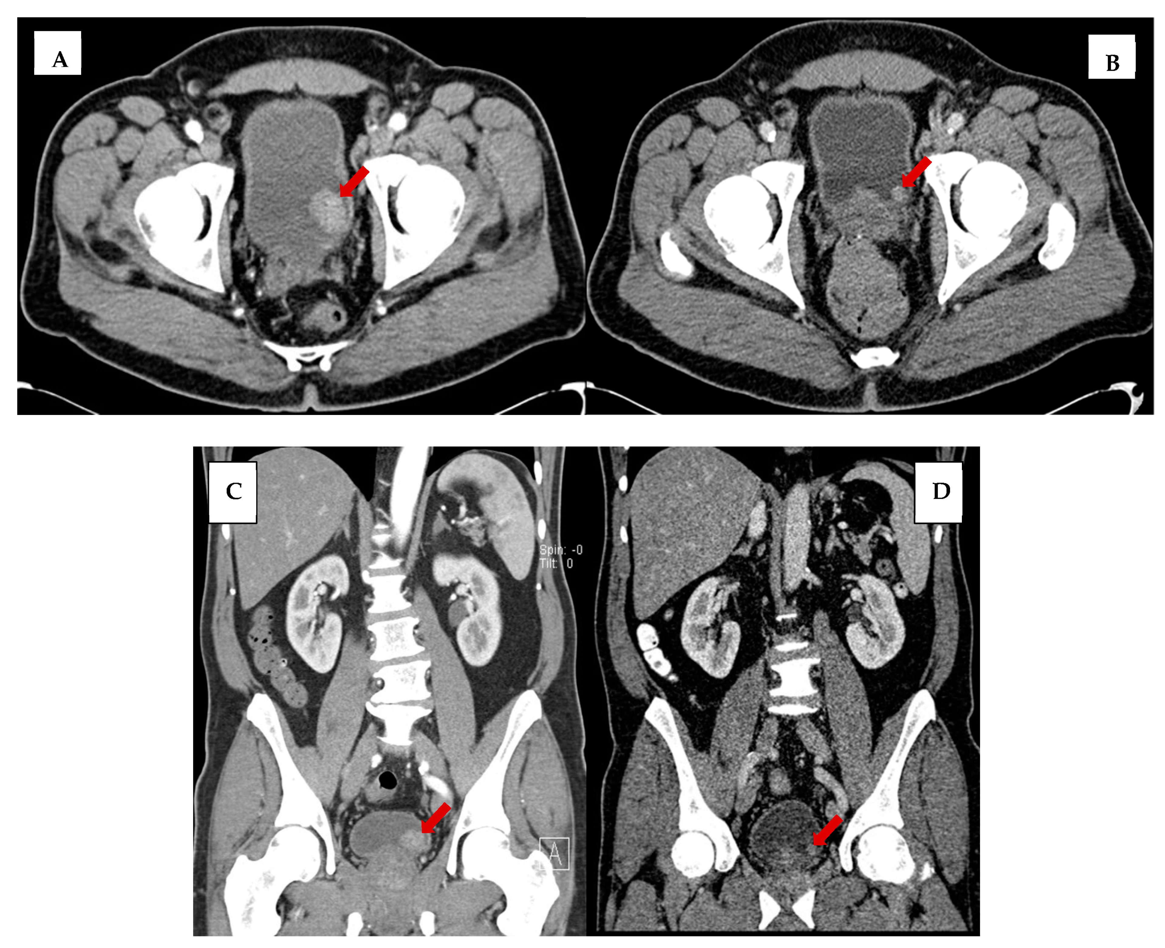 Tomography 09 00138 g005