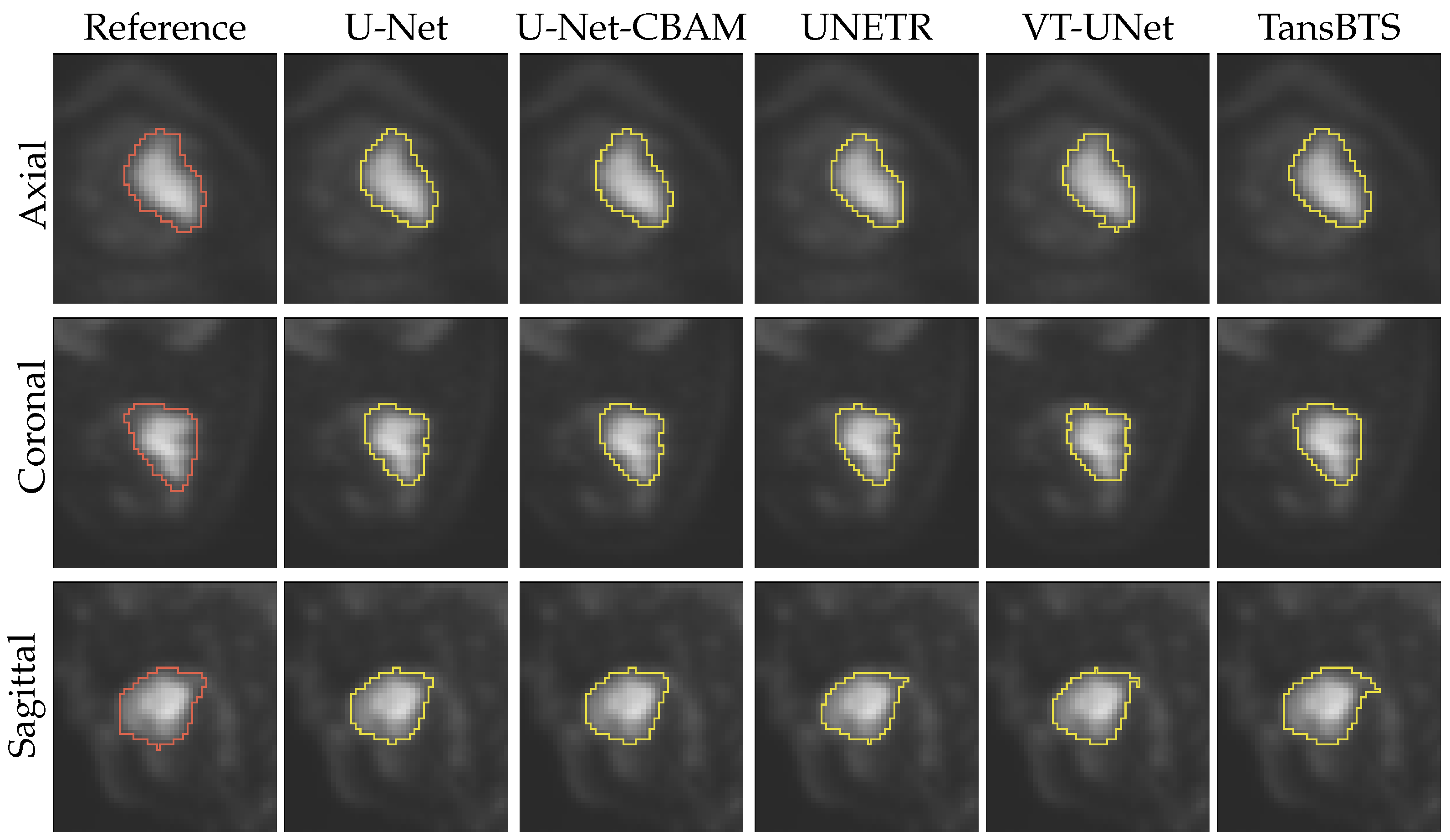 Tomography 09 00151 g011