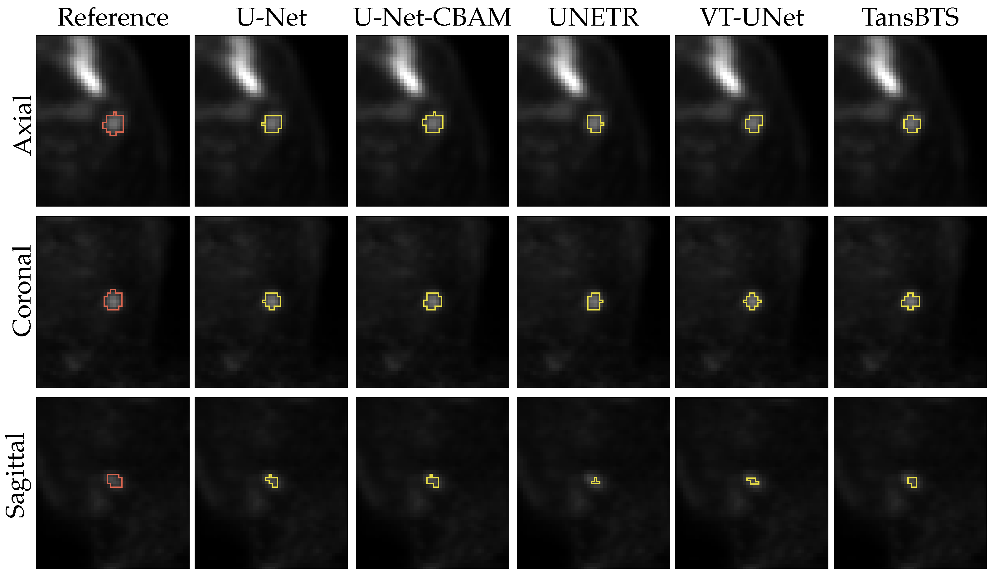Tomography 09 00151 g012