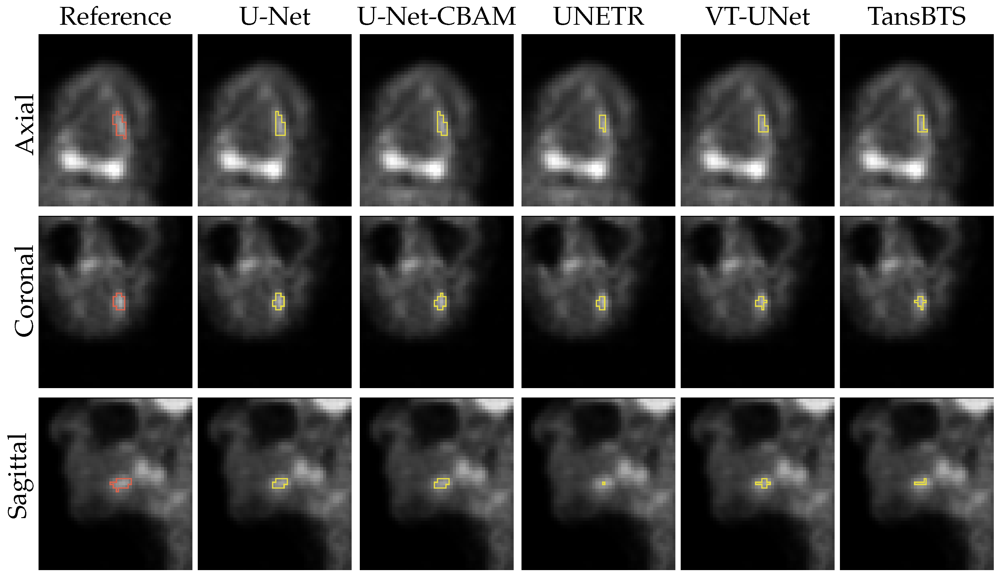 Tomography 09 00151 g013