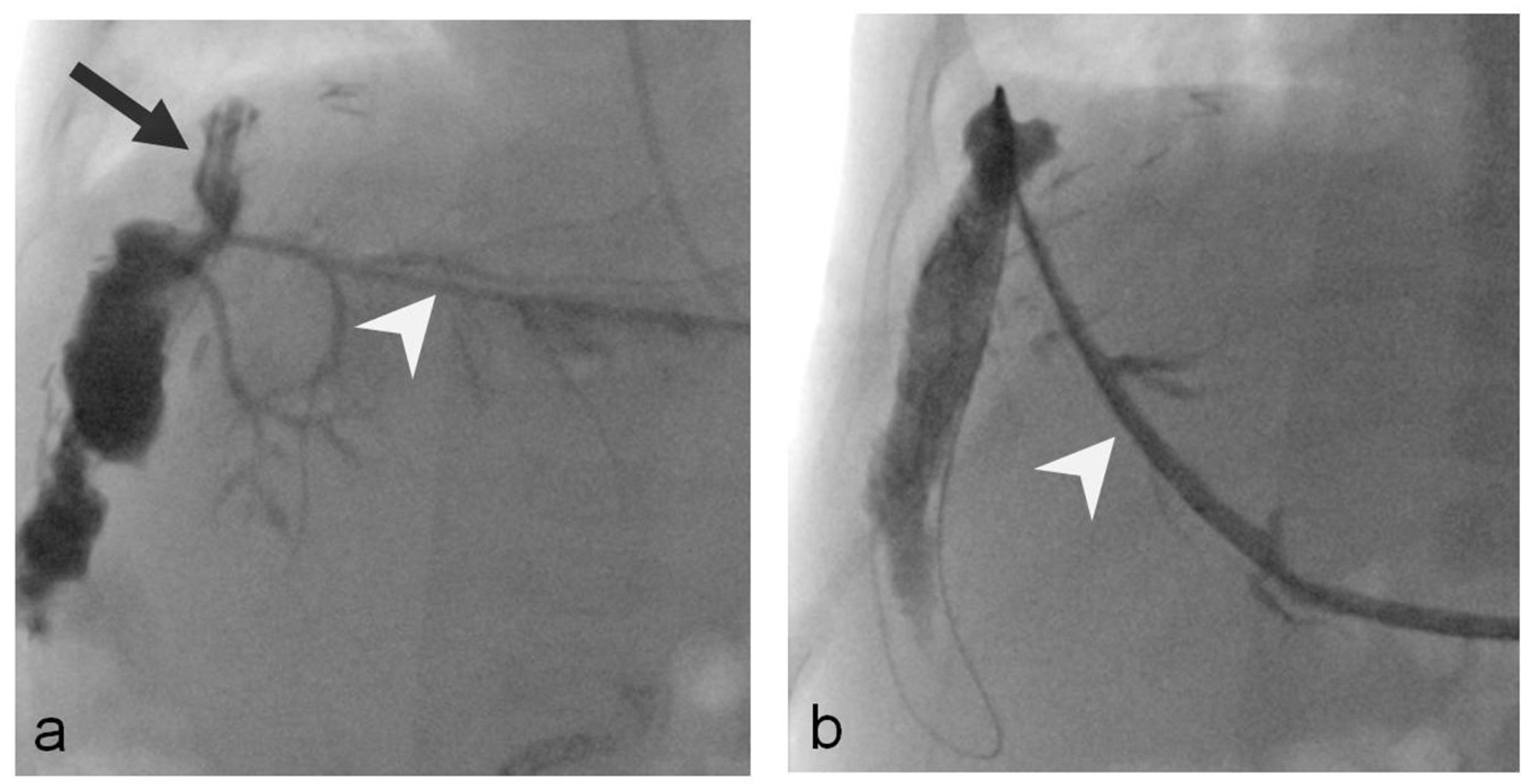 Tomography 09 00153 g003