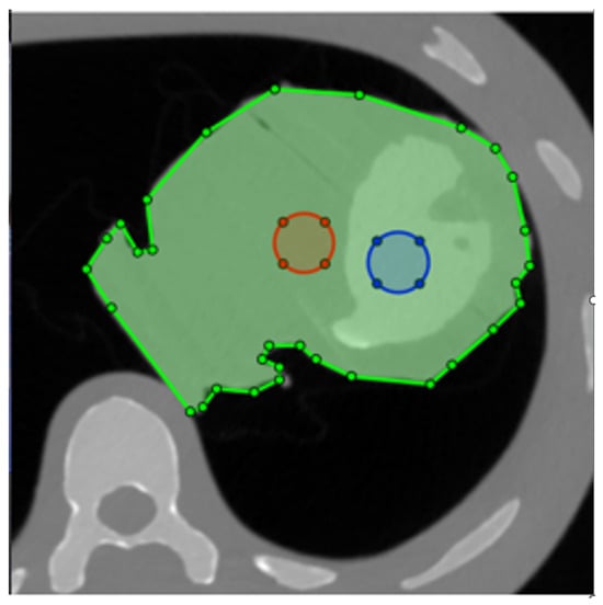 Tomography 09 00164 g002