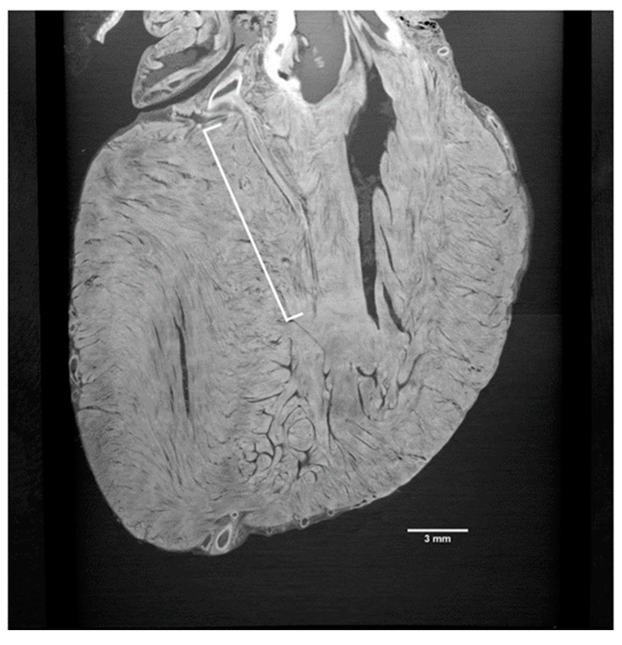 Tomography 09 00166 g002