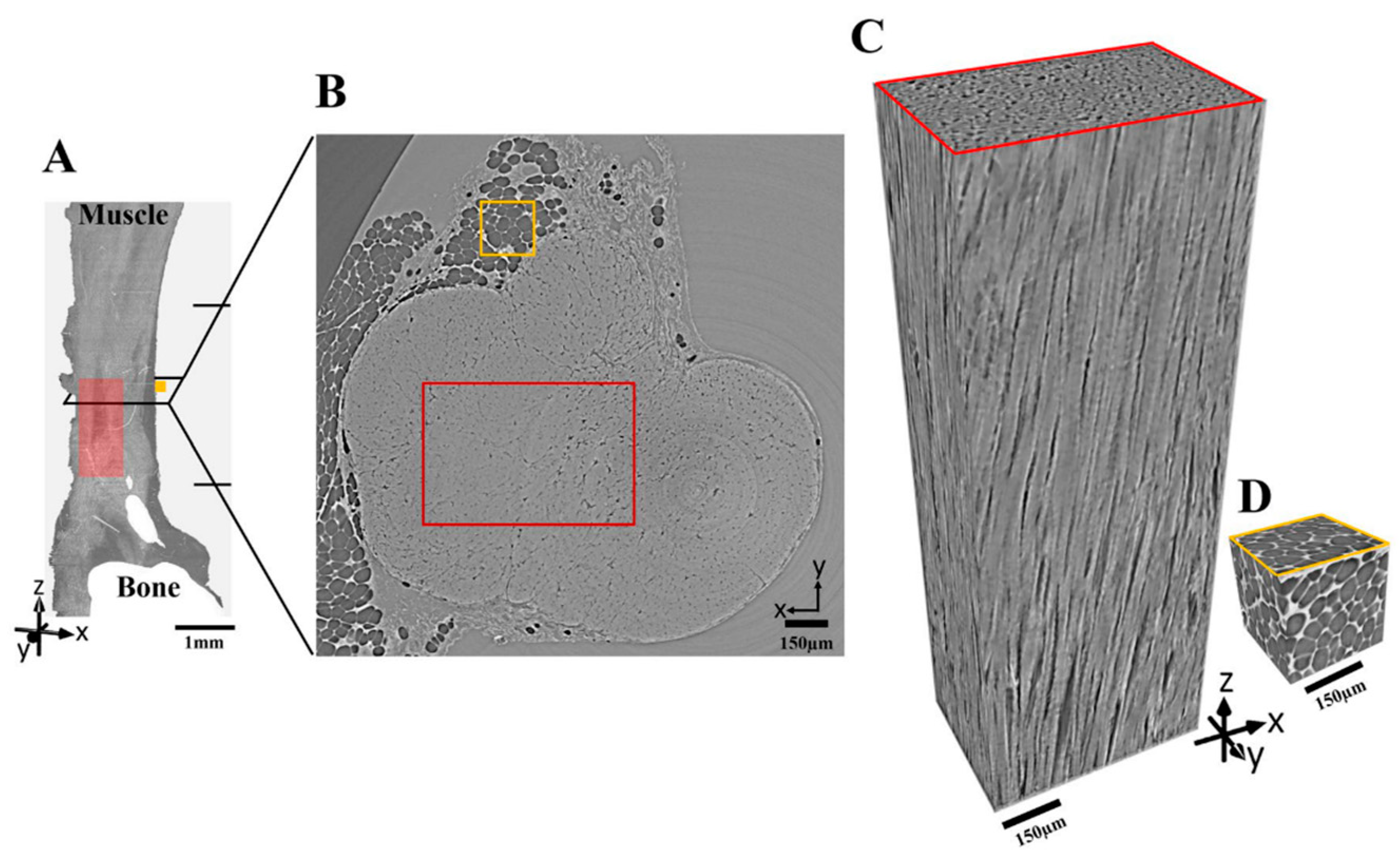 Tomography 09 00166 g004