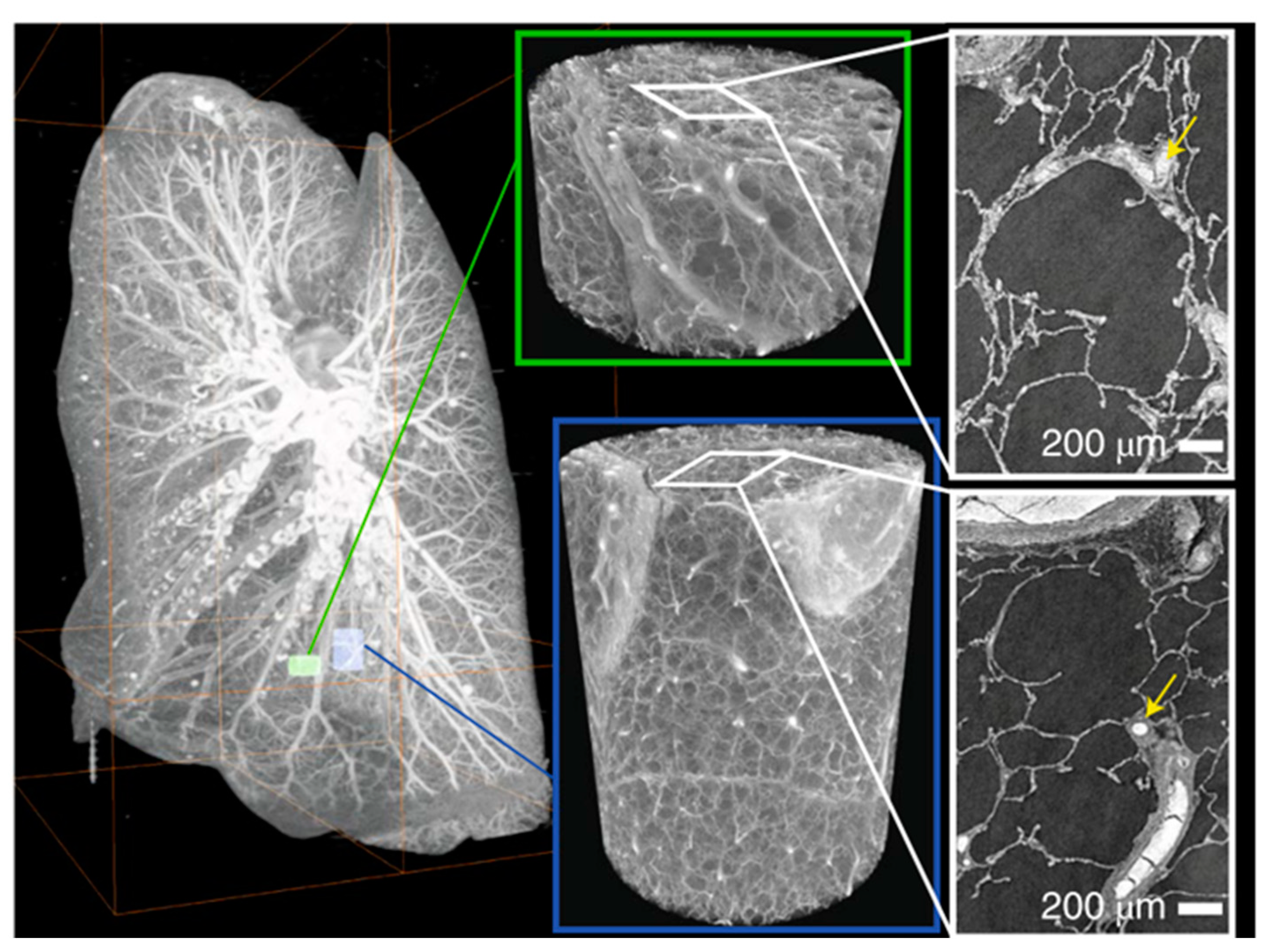 Tomography 09 00166 g005