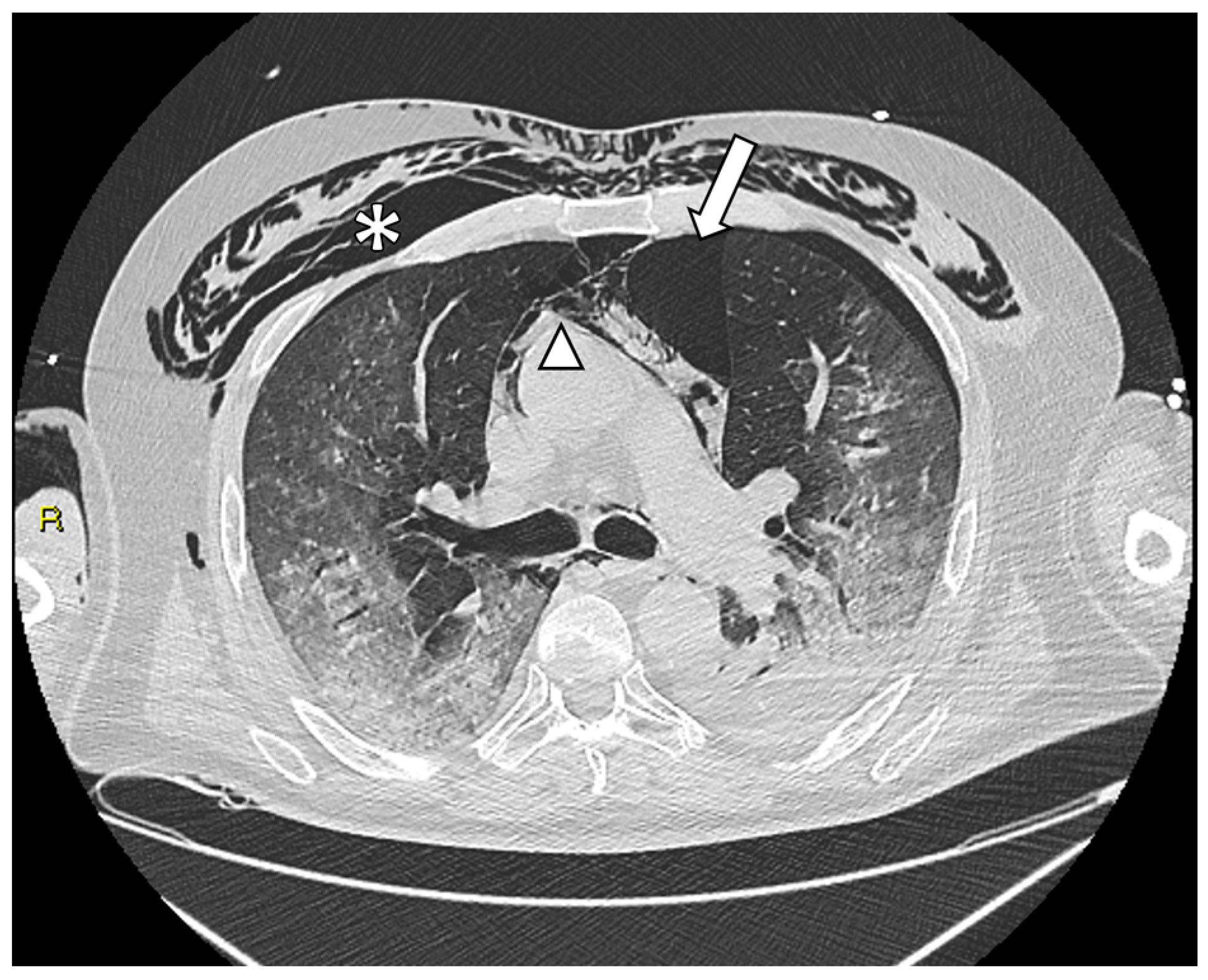 Tomography 09 00171 g001