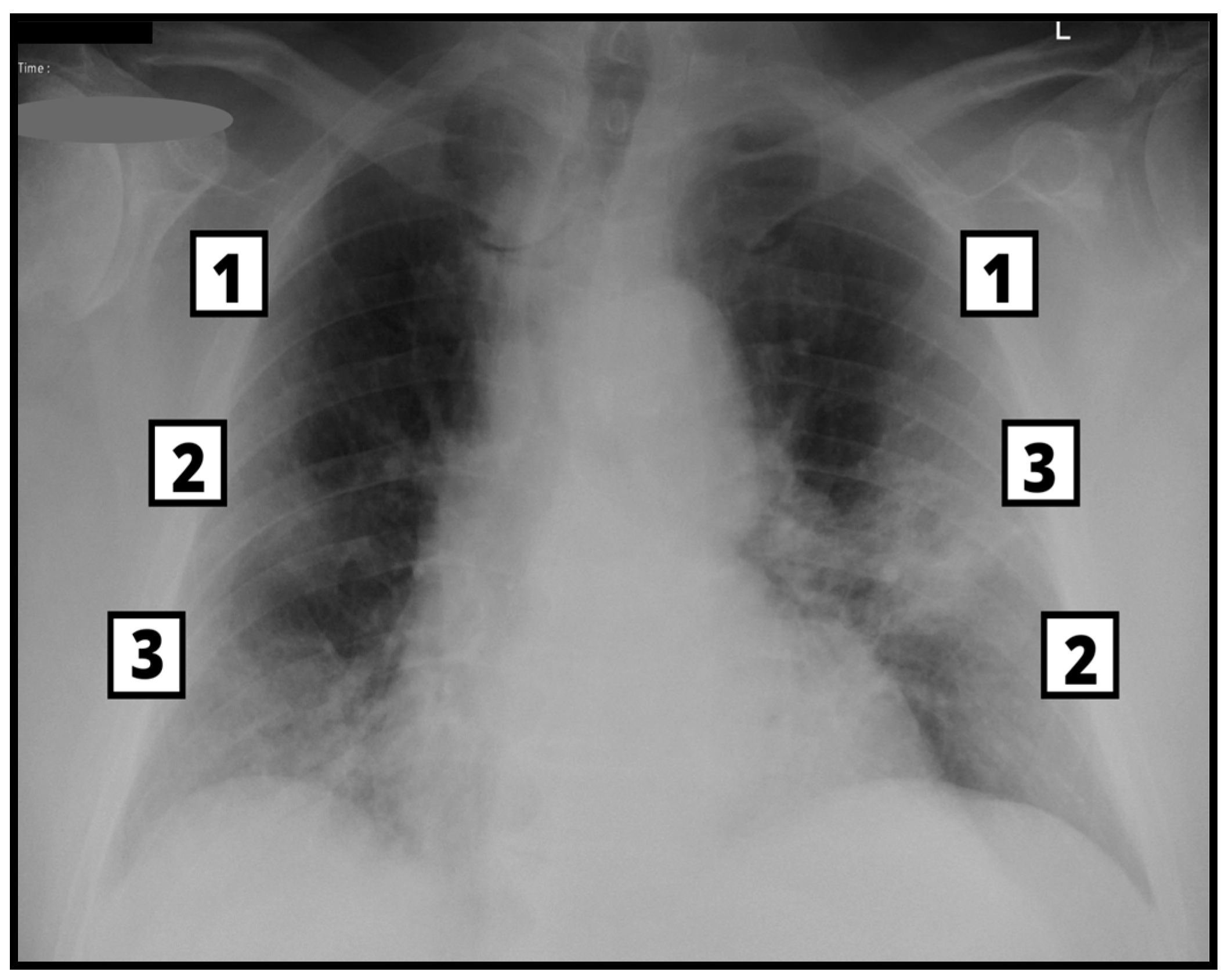 Tomography 09 00171 g003