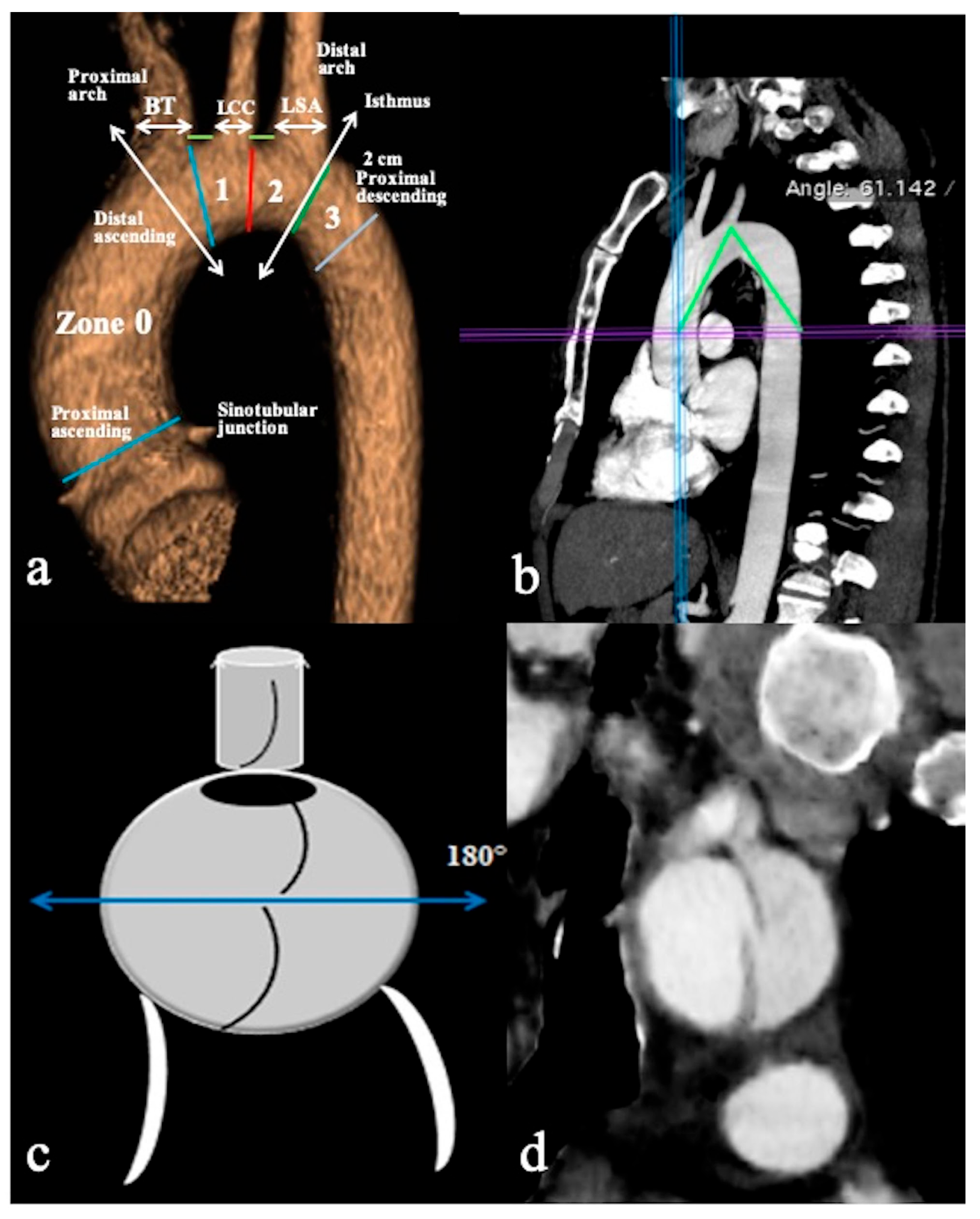 Tomography 09 00174 g001