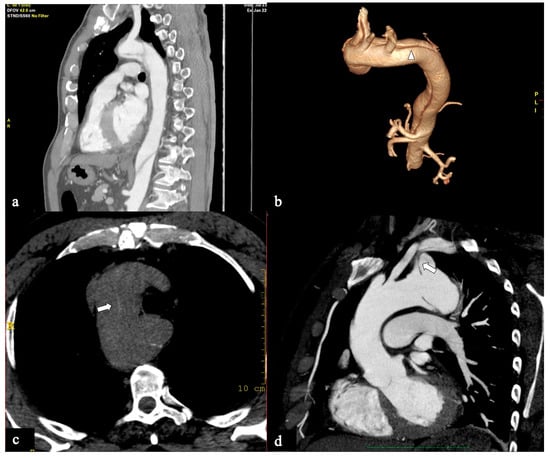 Tomography 09 00174 g003