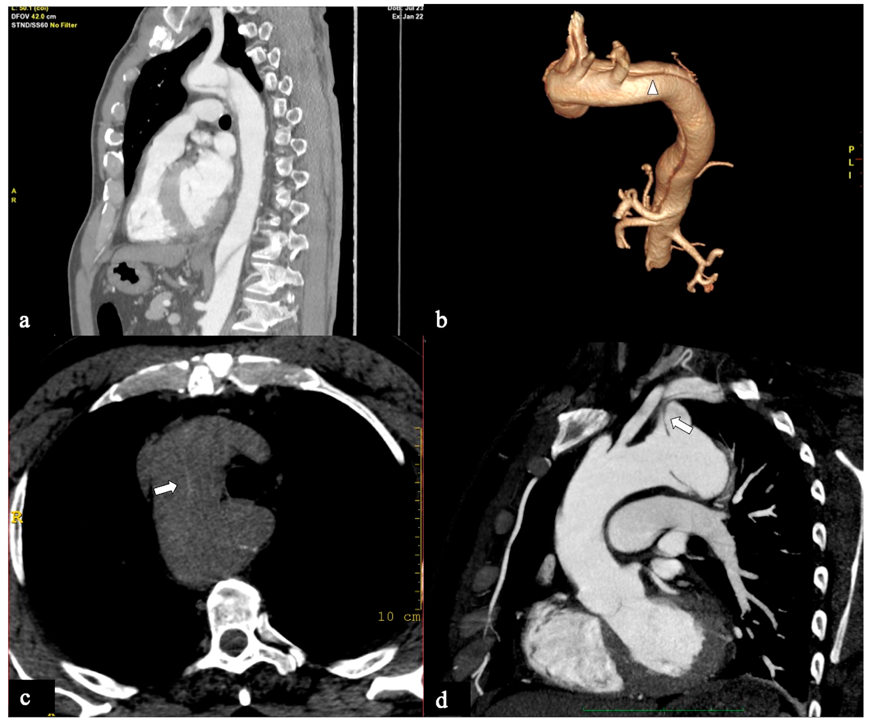 Tomography 09 00174 g003