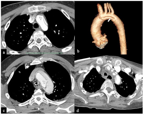 Tomography 09 00174 g004