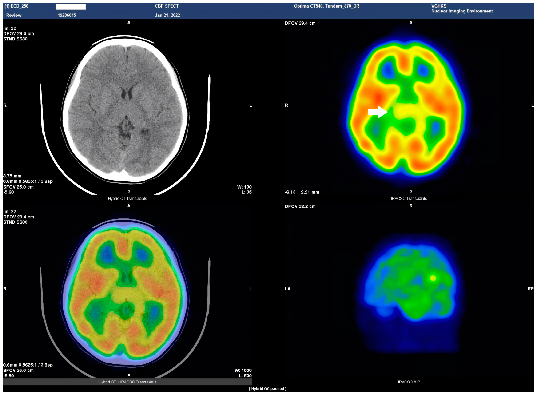 Tomography 09 00175 g003