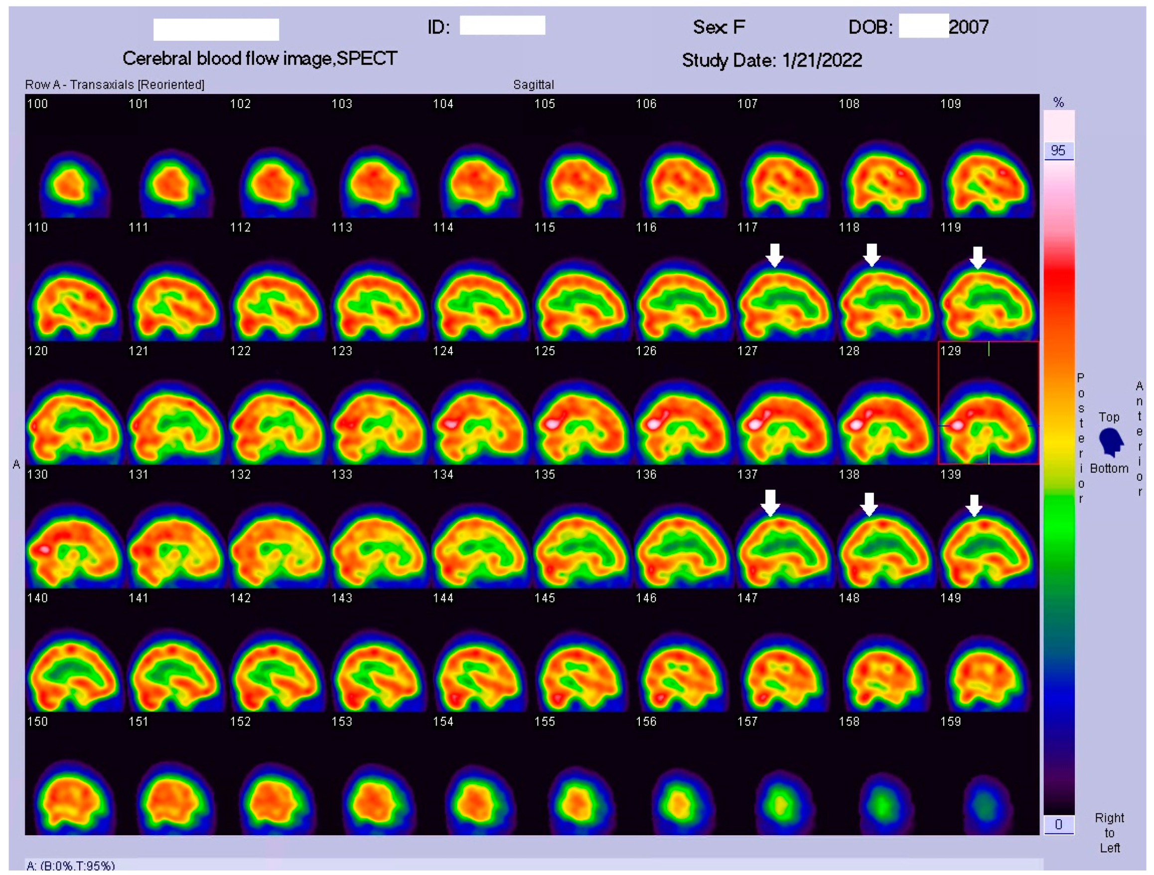Tomography 09 00175 g005