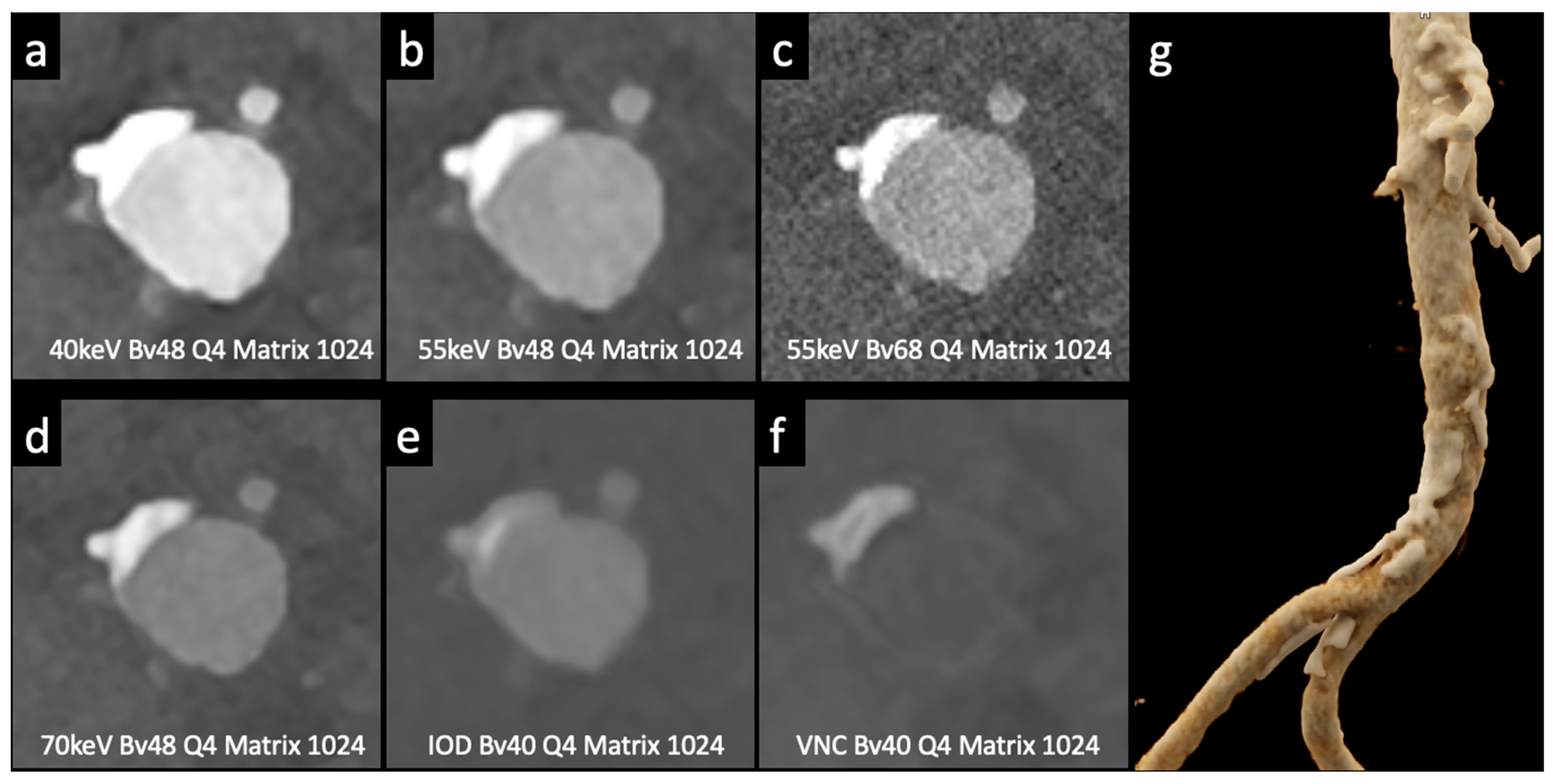 Tomography 10 00001 g003 Tomography 10 00001 g003