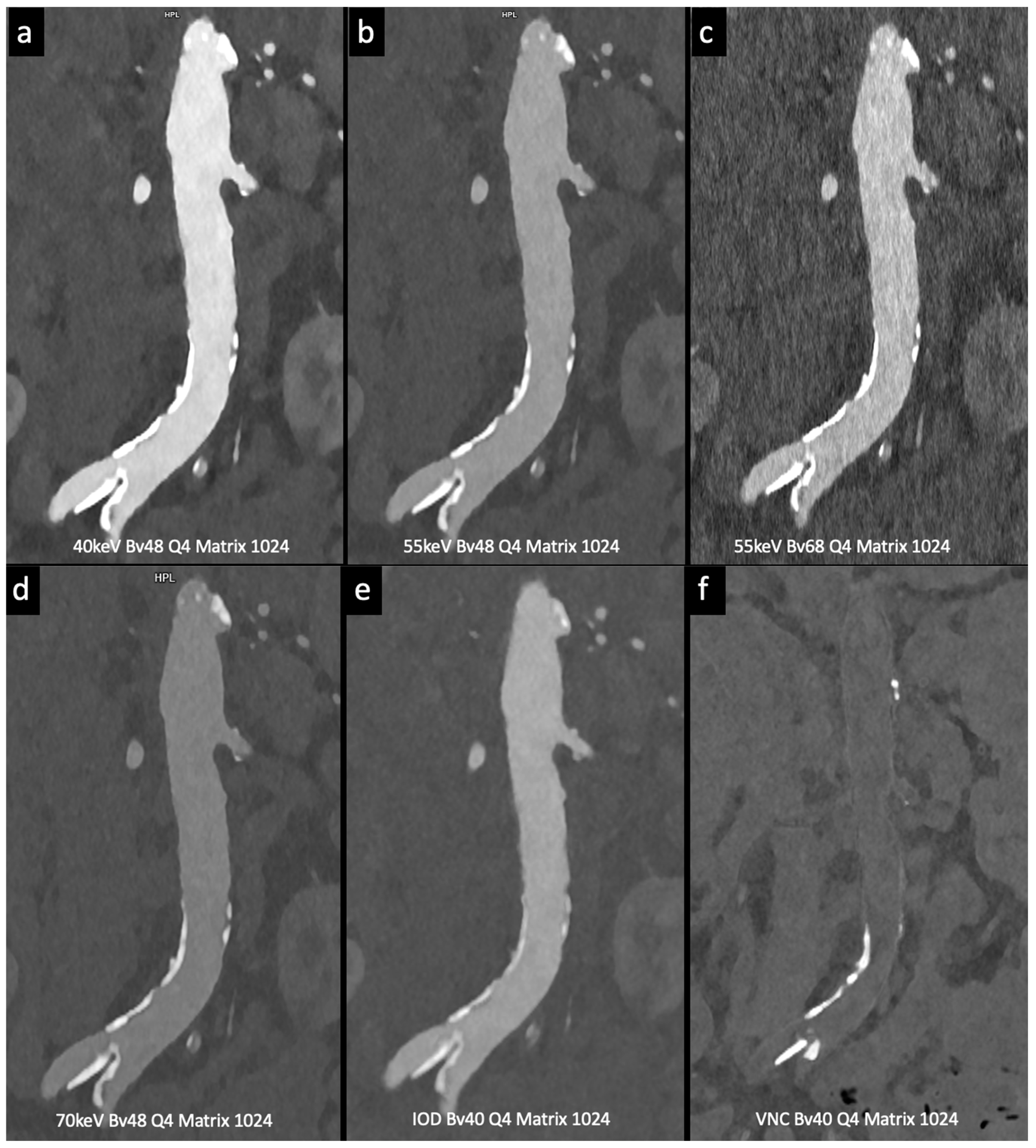 Tomography 10 00001 g004 Tomography 10 00001 g004