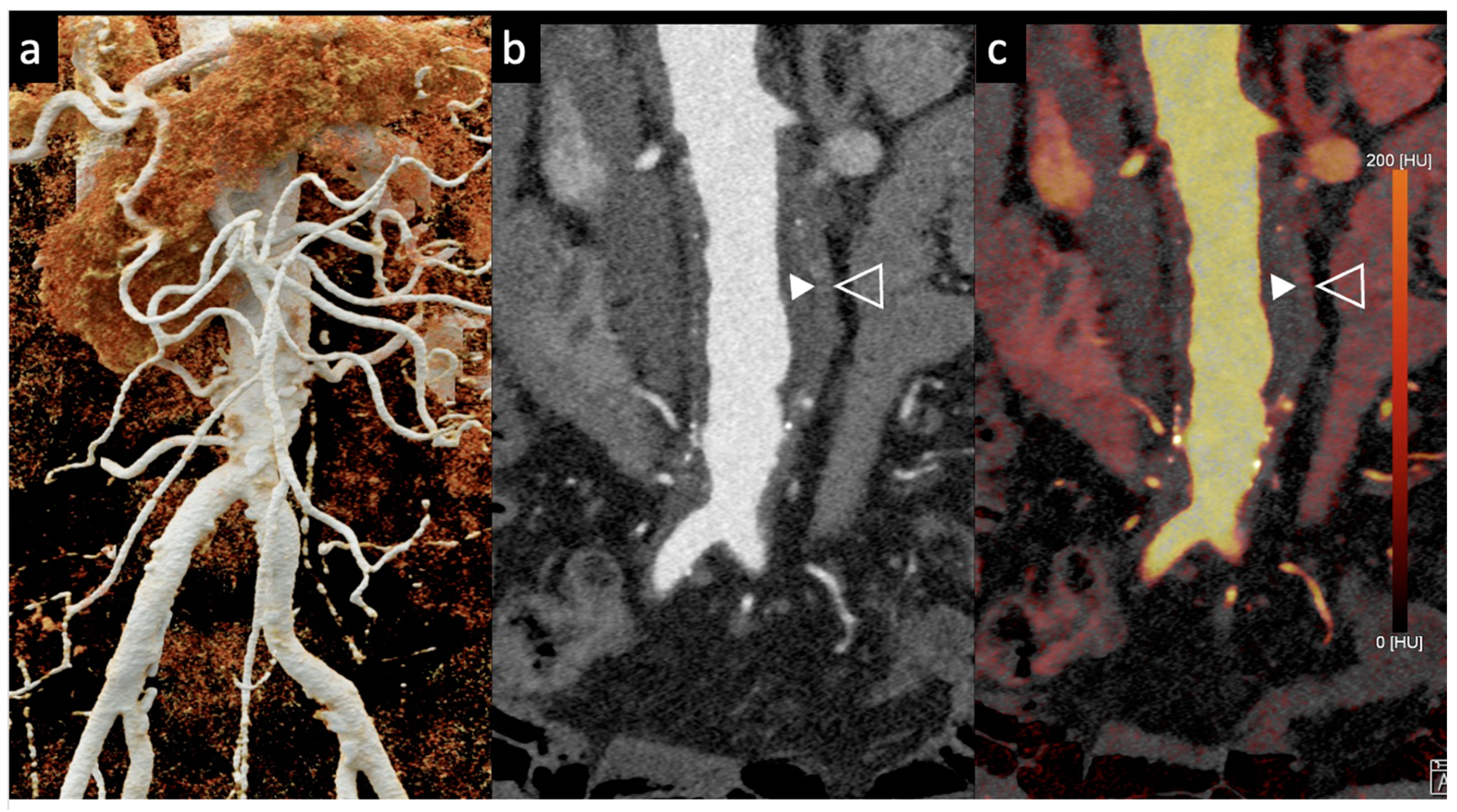 Tomography 10 00001 g005 Tomography 10 00001 g005