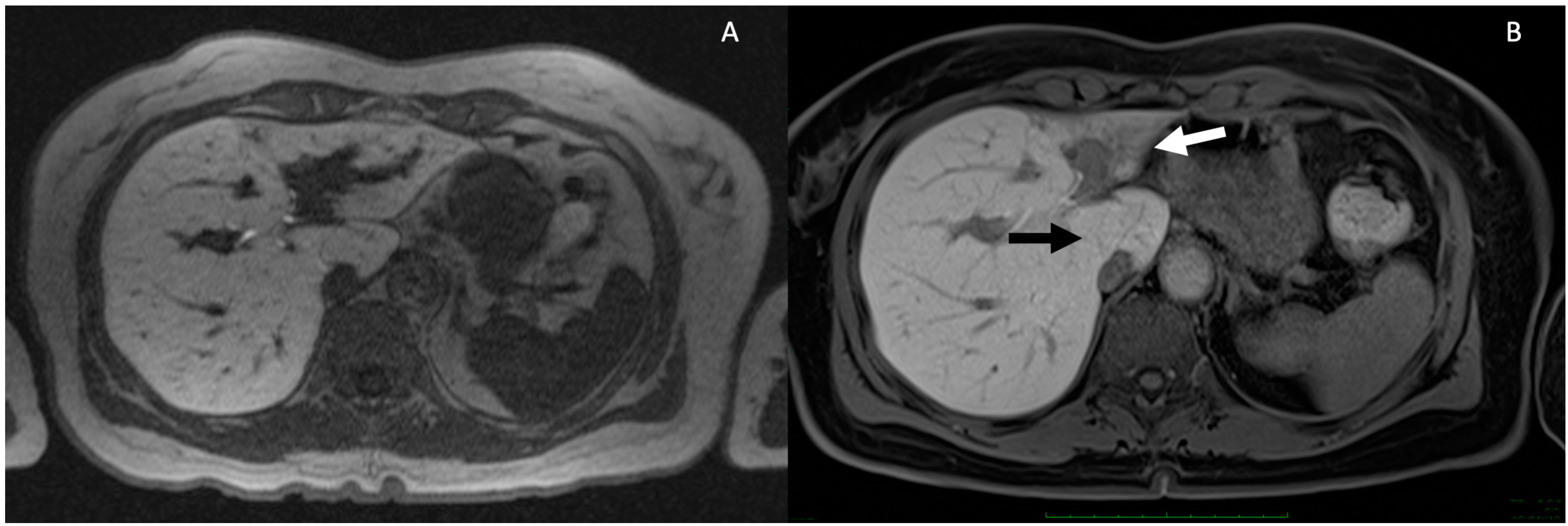 Tomography 10 00005 g004