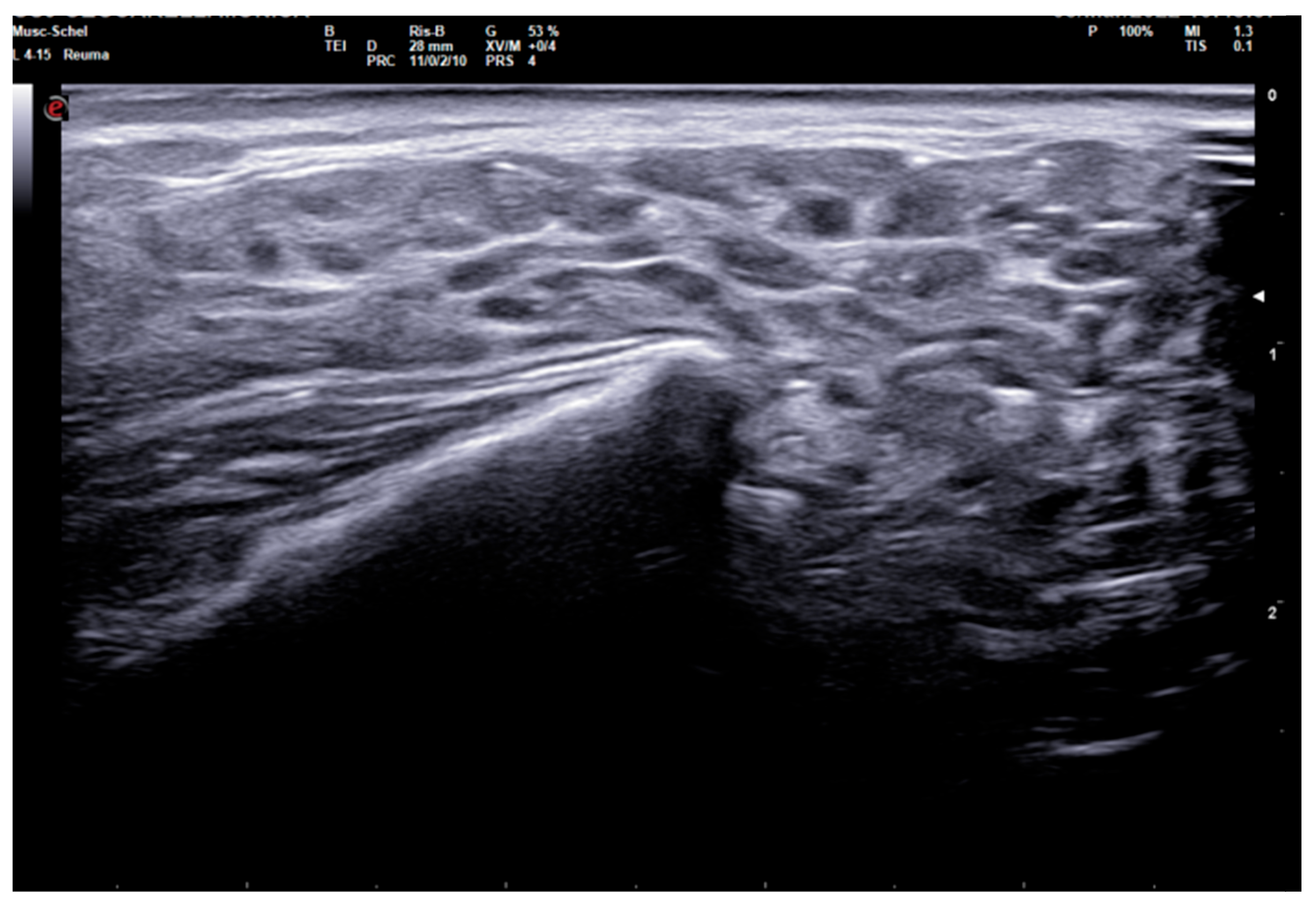 Tomography 10 00006 g001