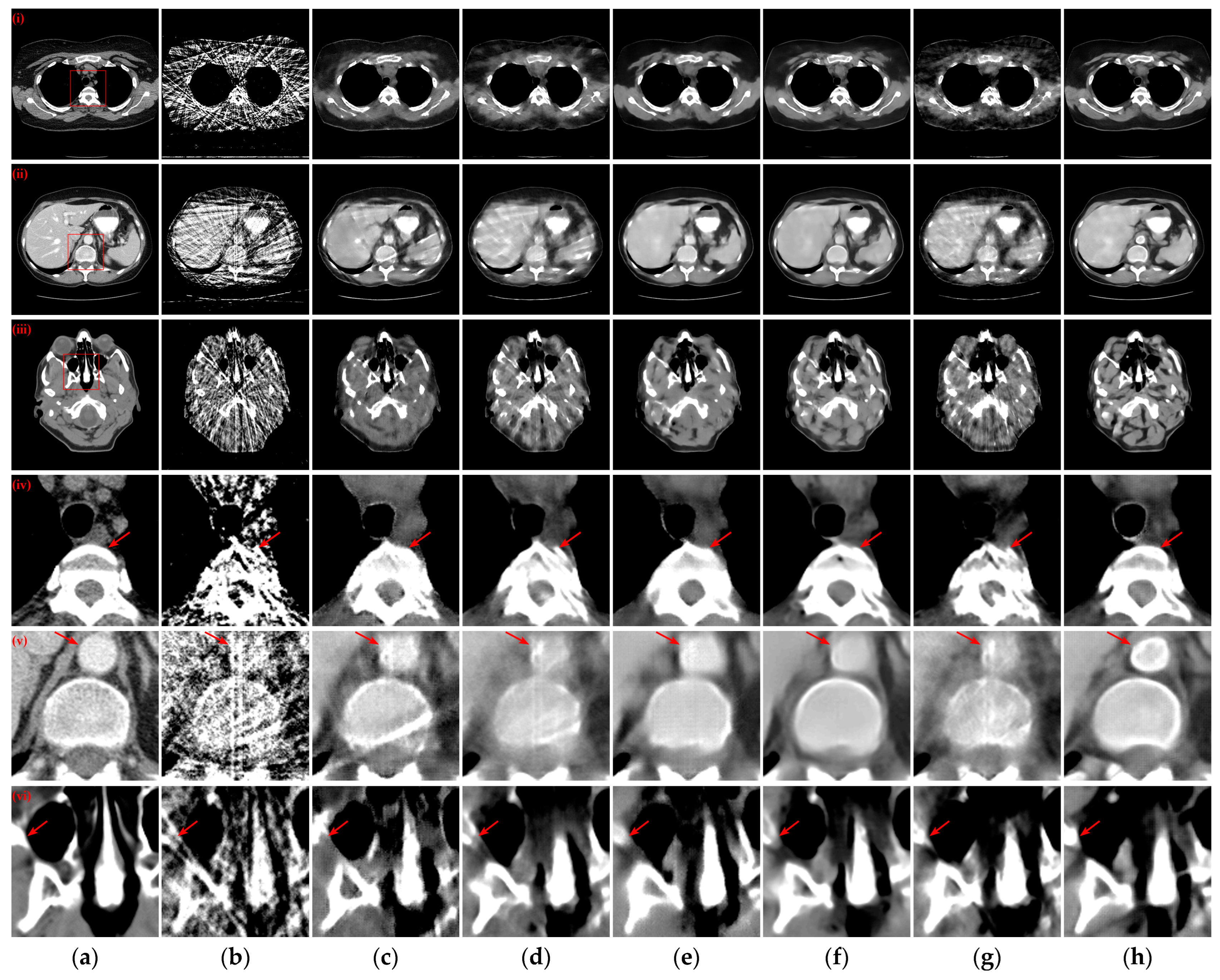 Tomography 10 00011 g006