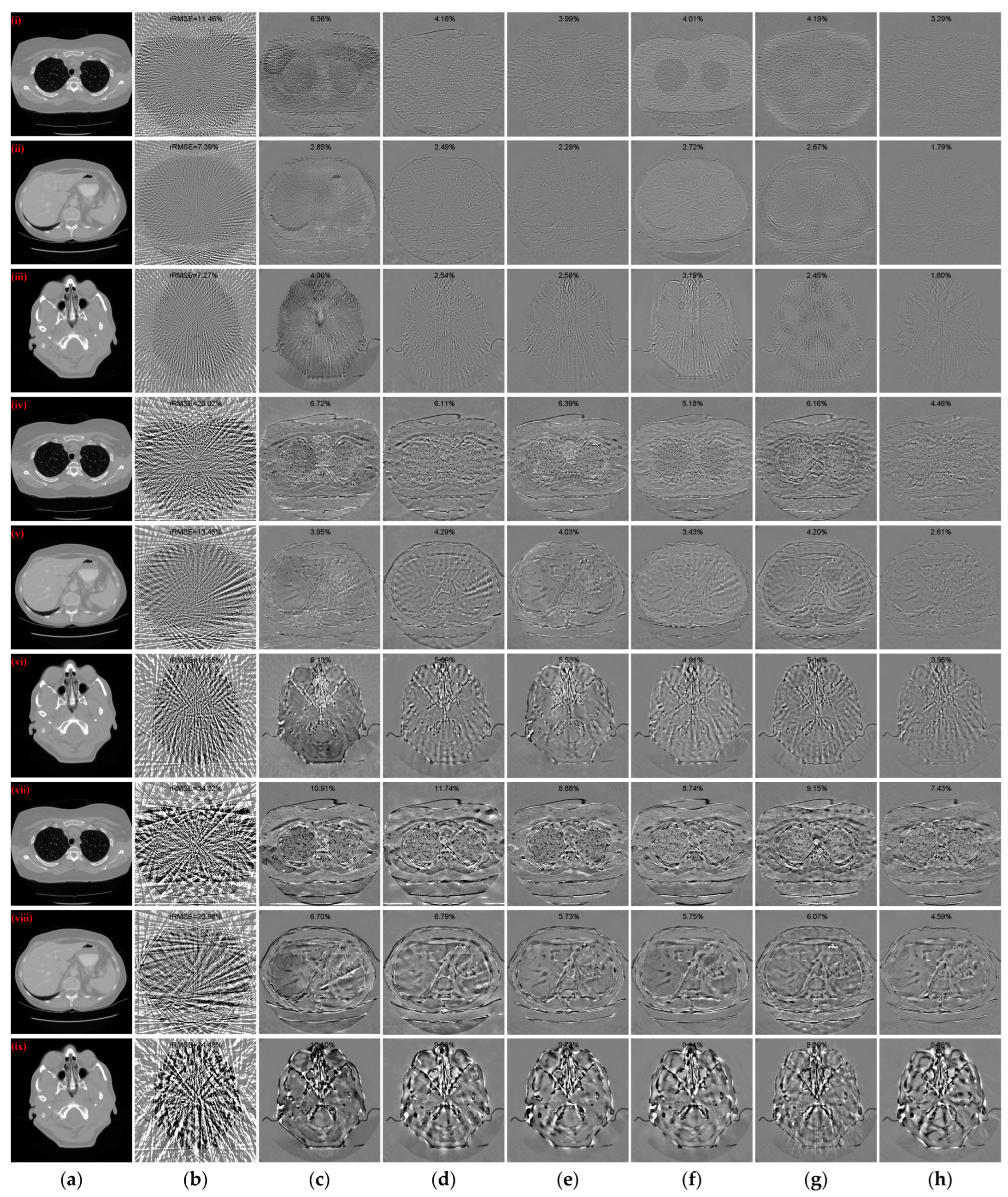 Tomography 10 00011 g007